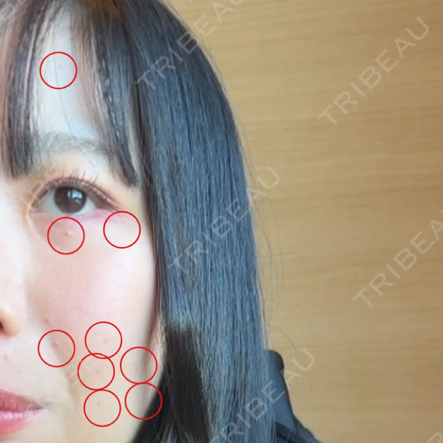施術前の写真