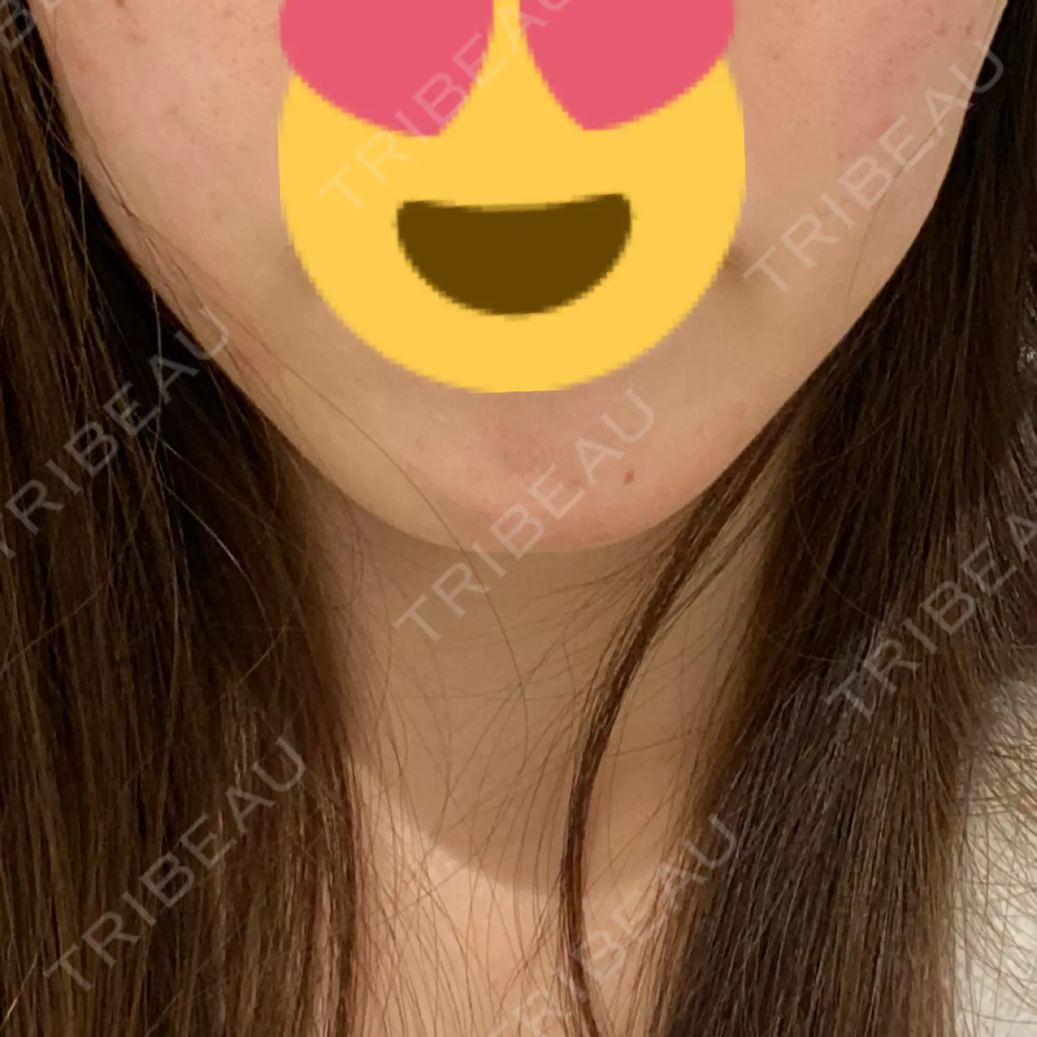 施術前の写真
