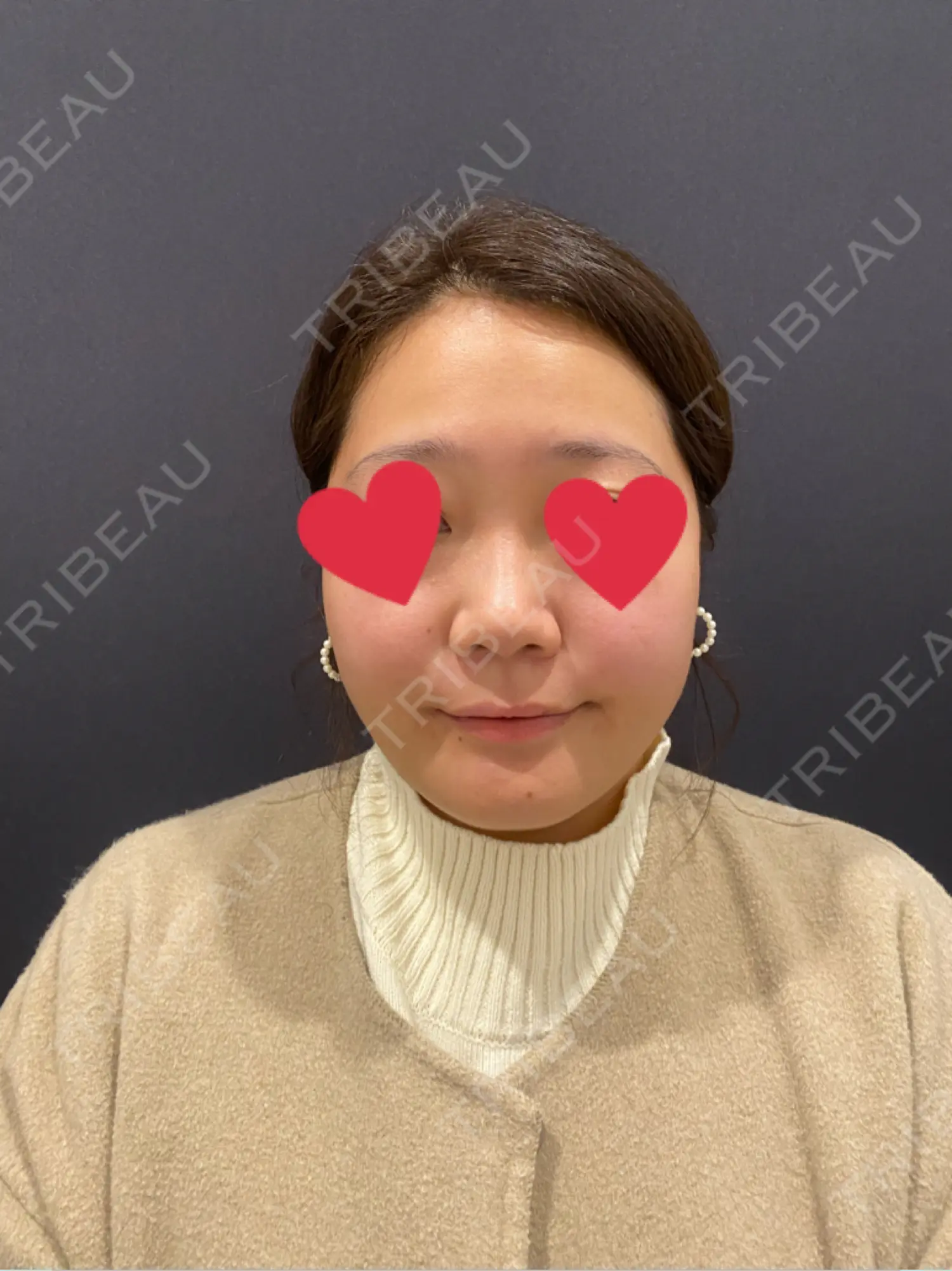 施術前の写真