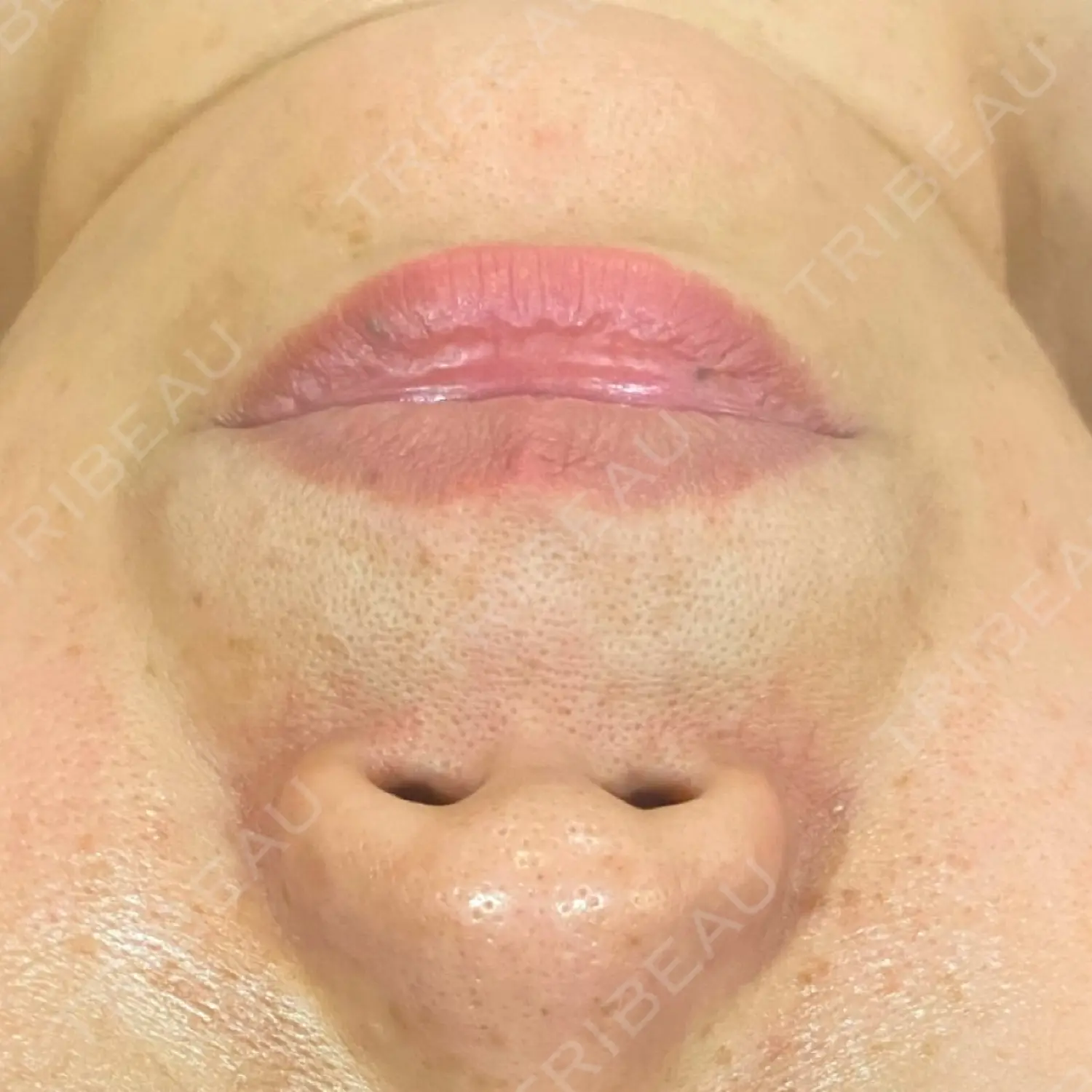 施術前の写真