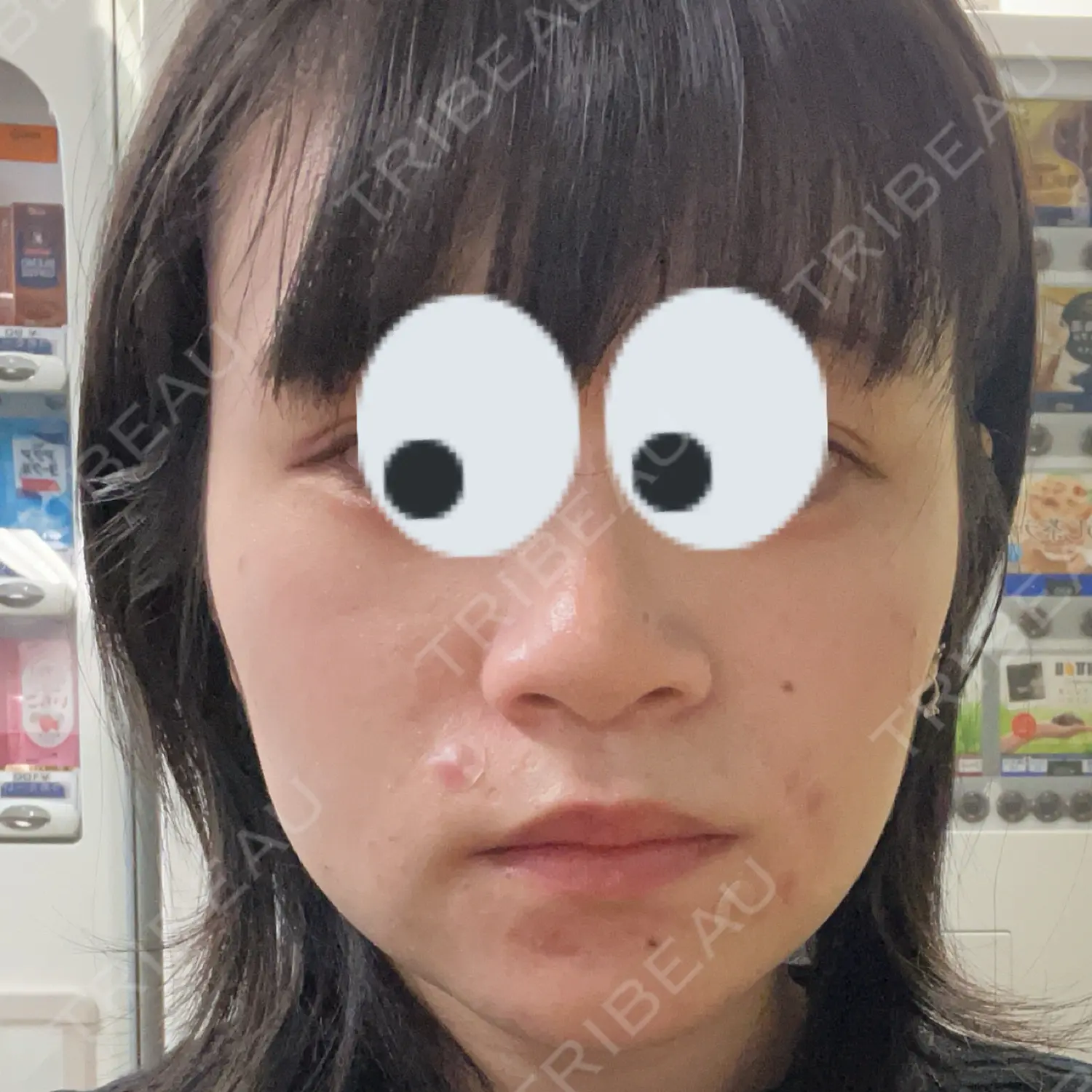 施術前の写真