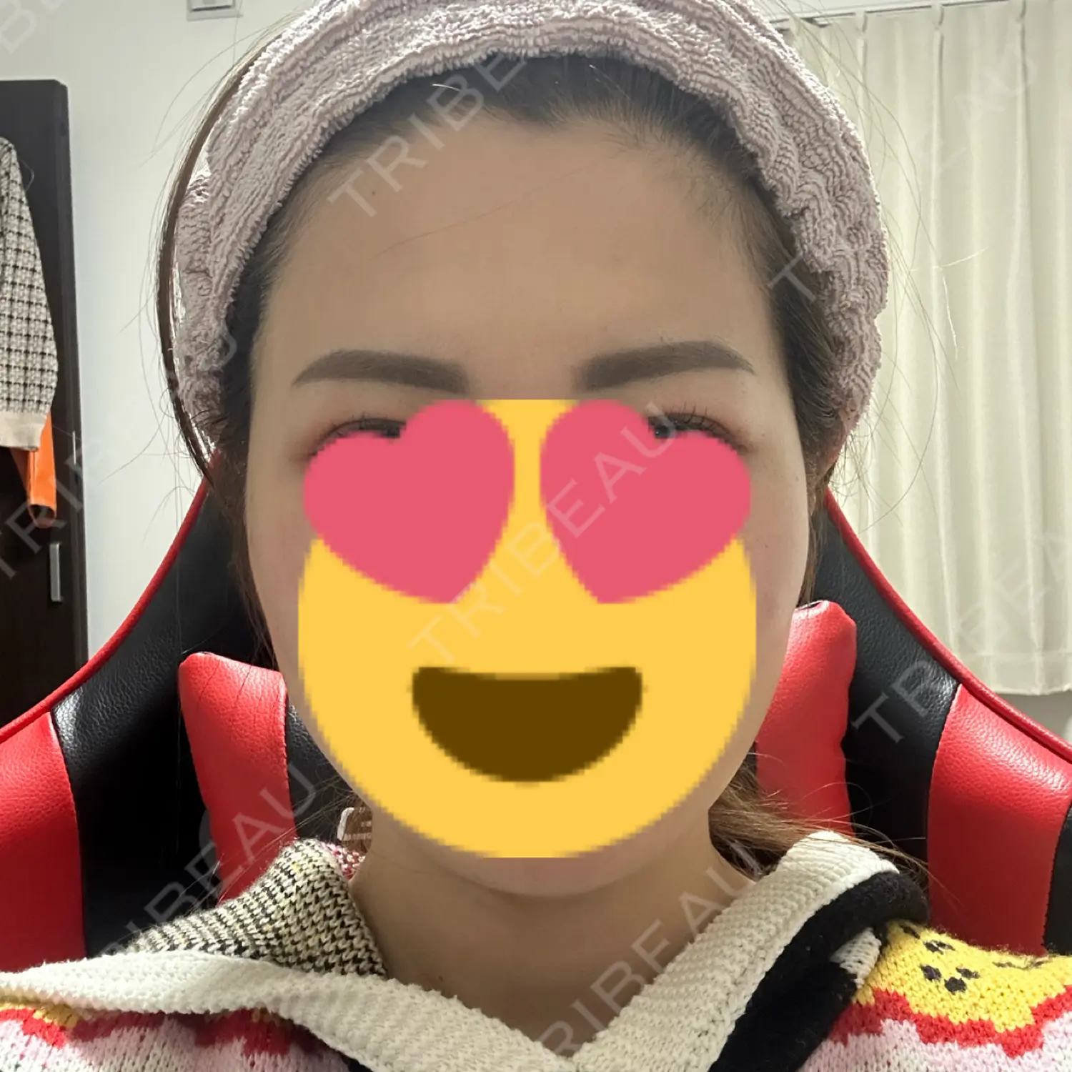 施術前の写真