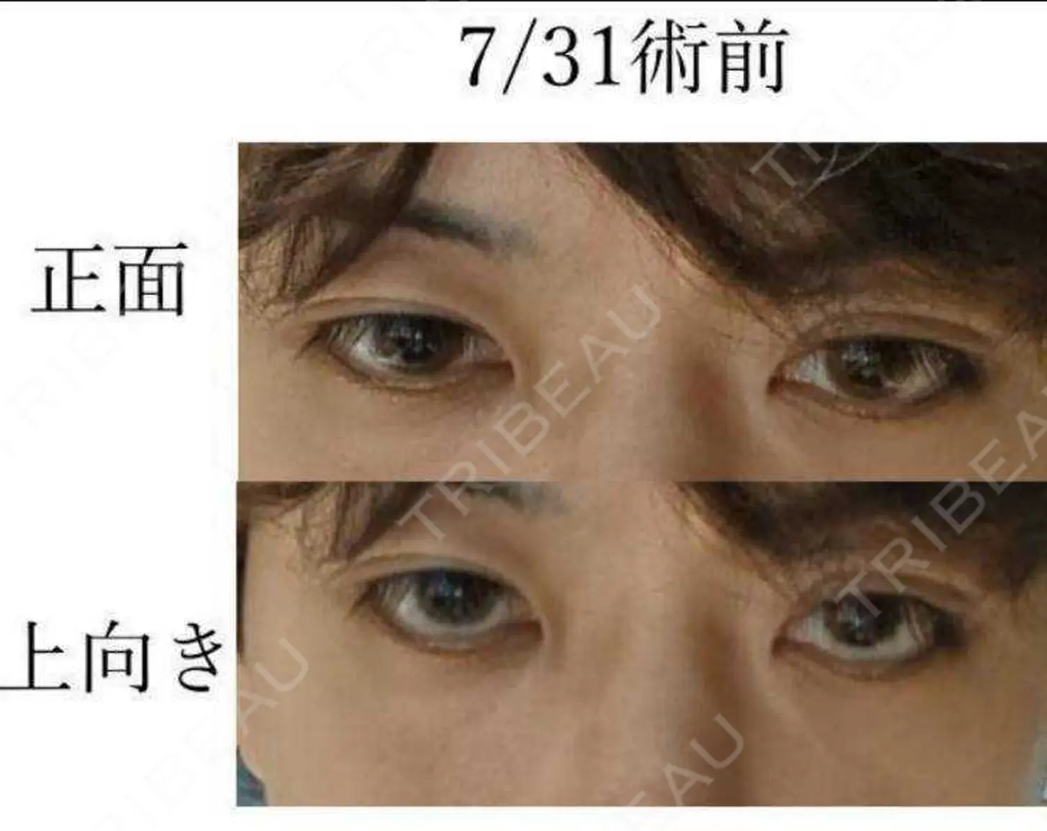 施術前の写真