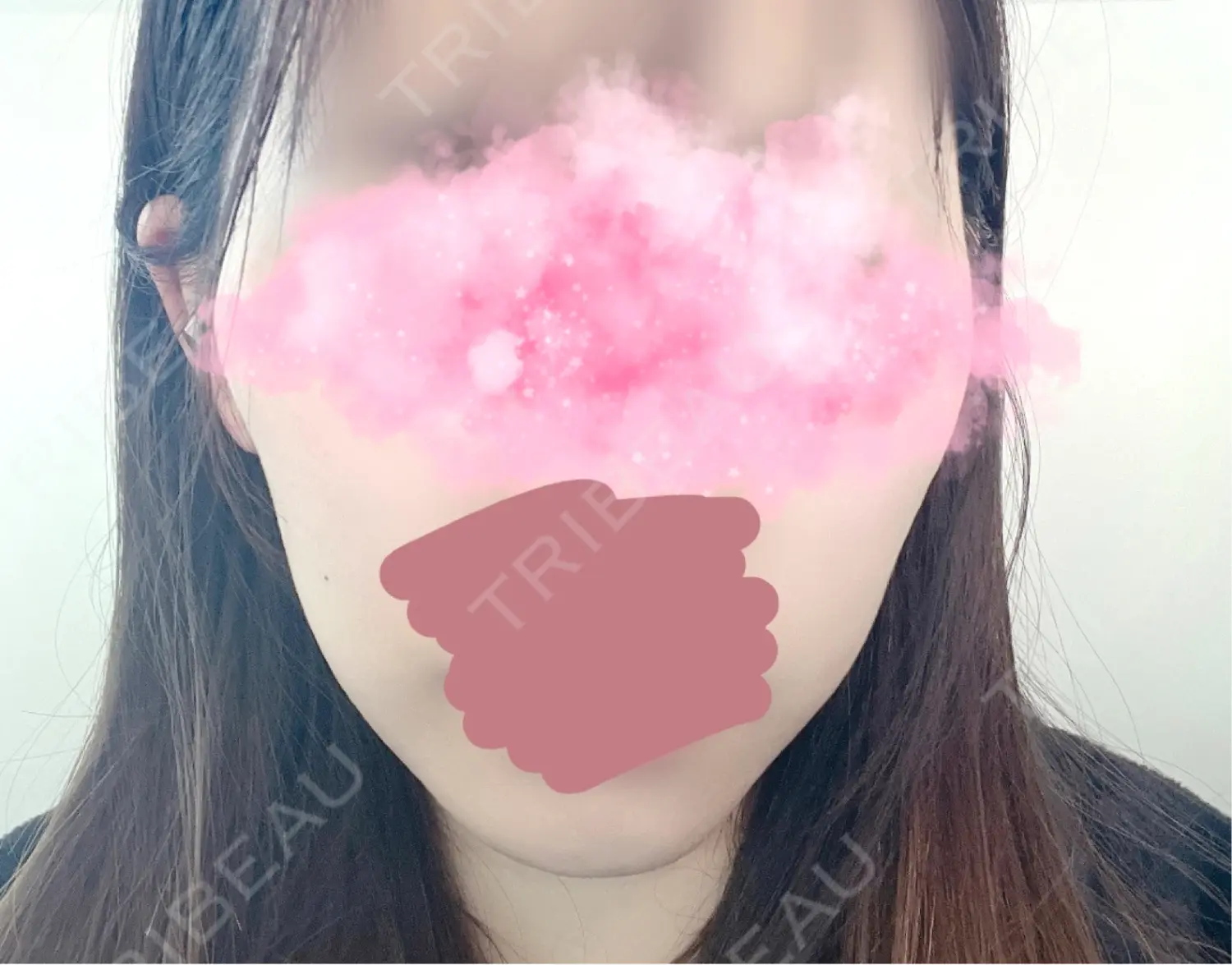 施術前の写真