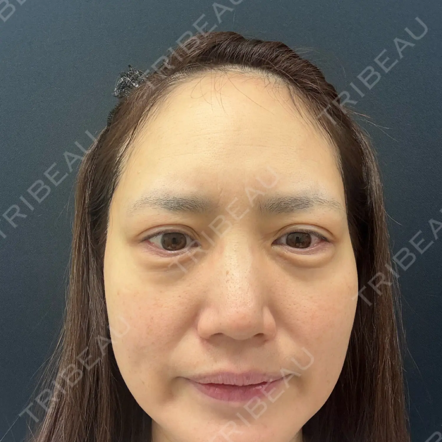 施術前の写真