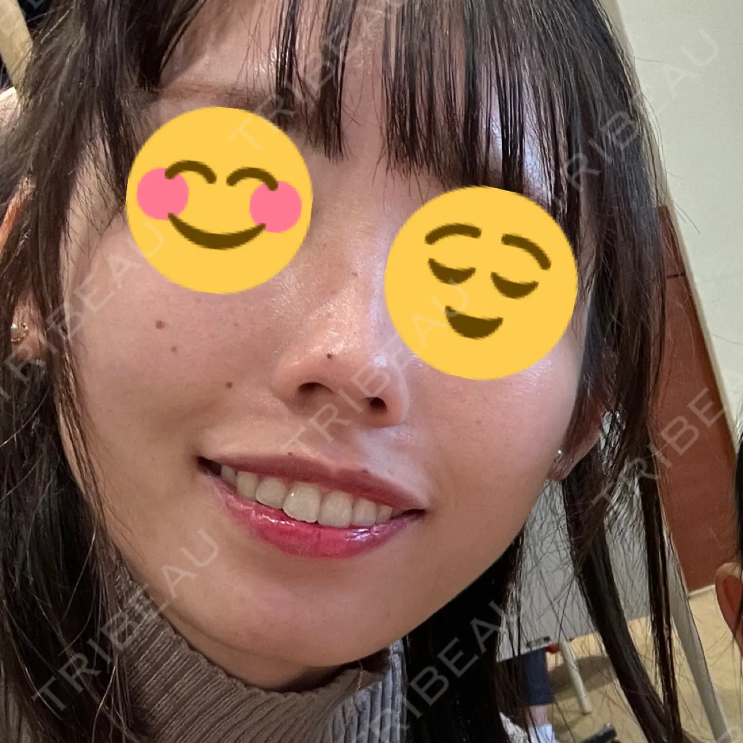 施術前の写真