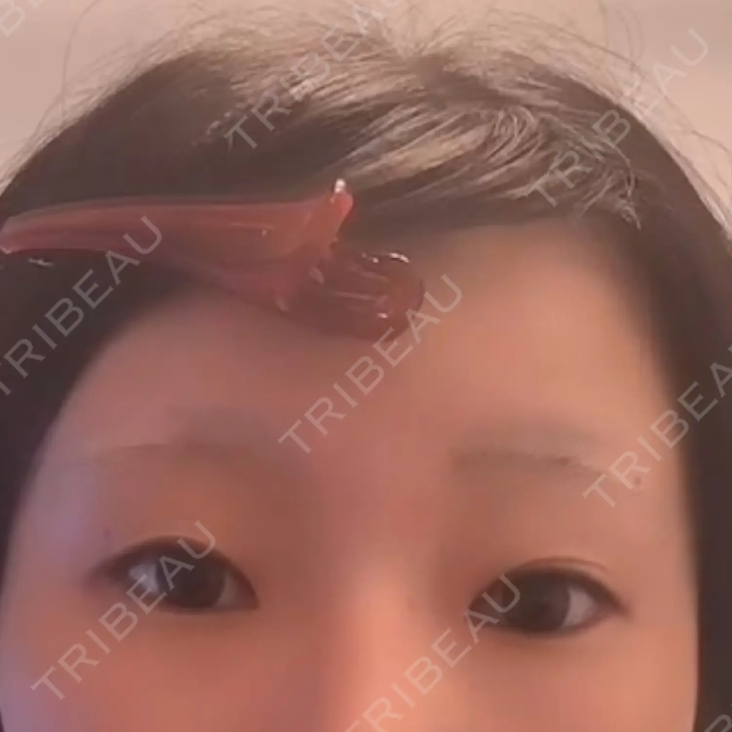 施術前の写真