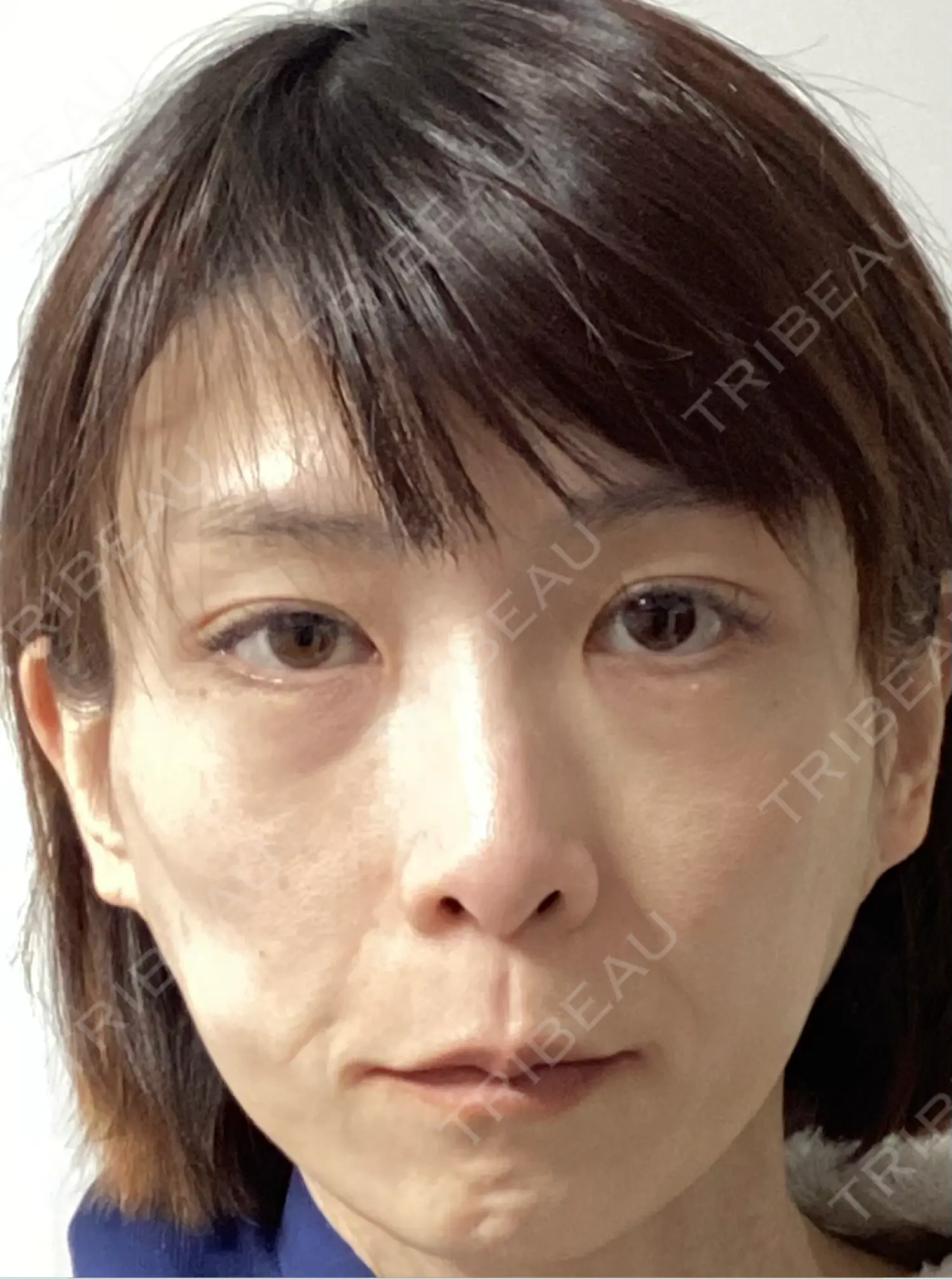 施術前の写真
