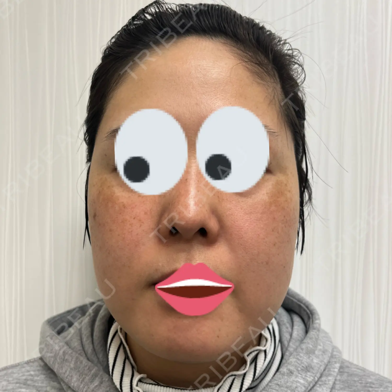 施術前の写真
