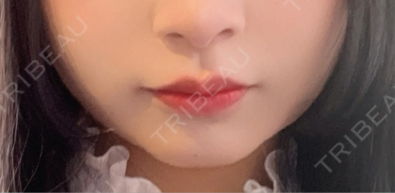 施術前の写真