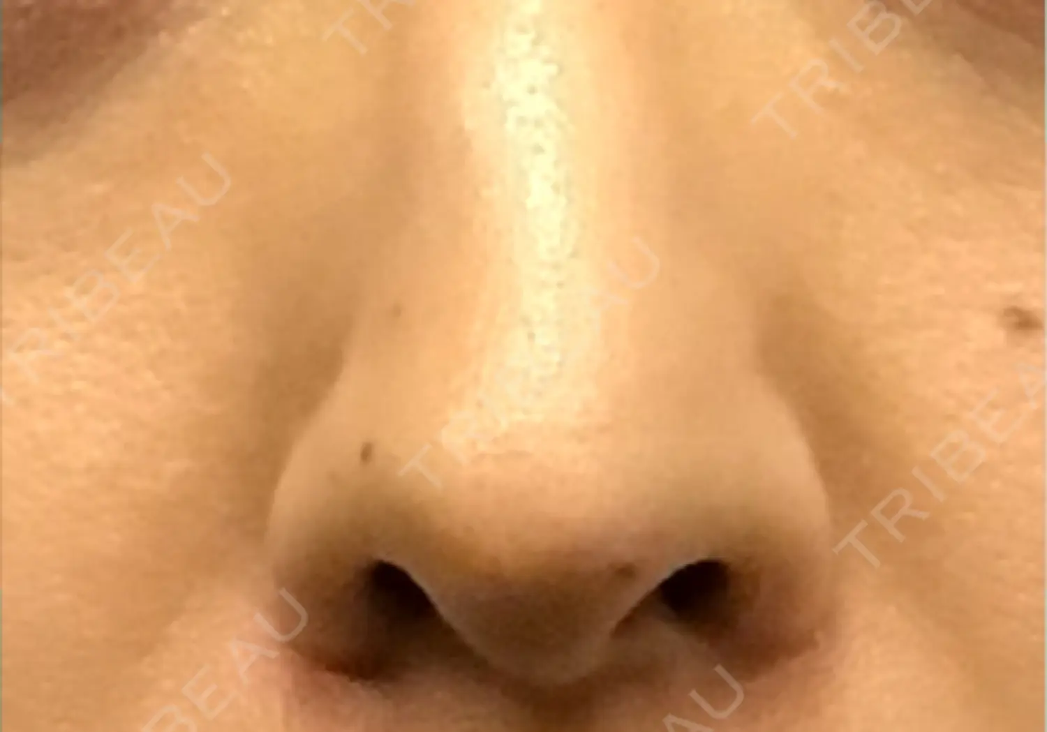 施術前の写真