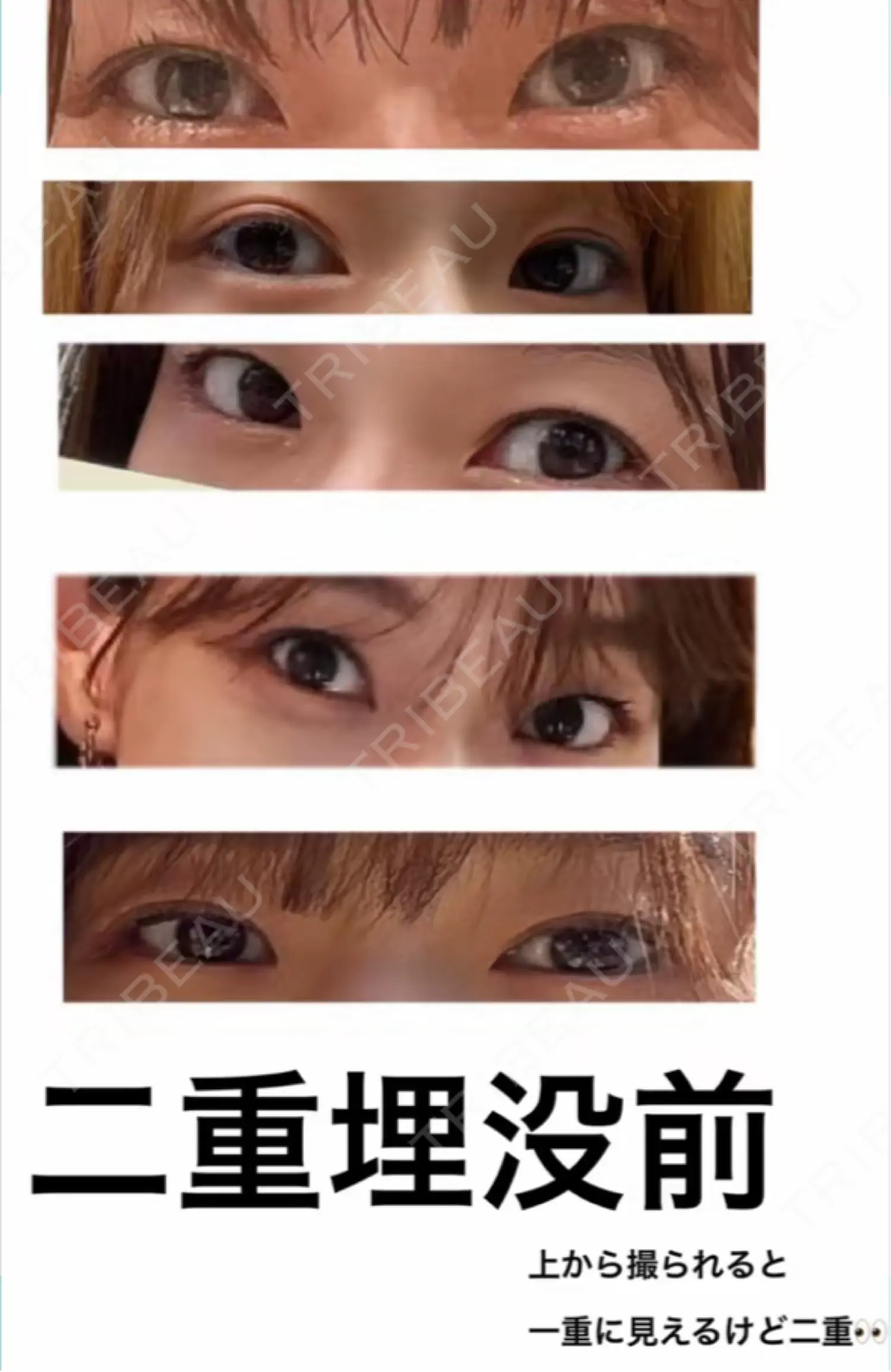施術前の写真