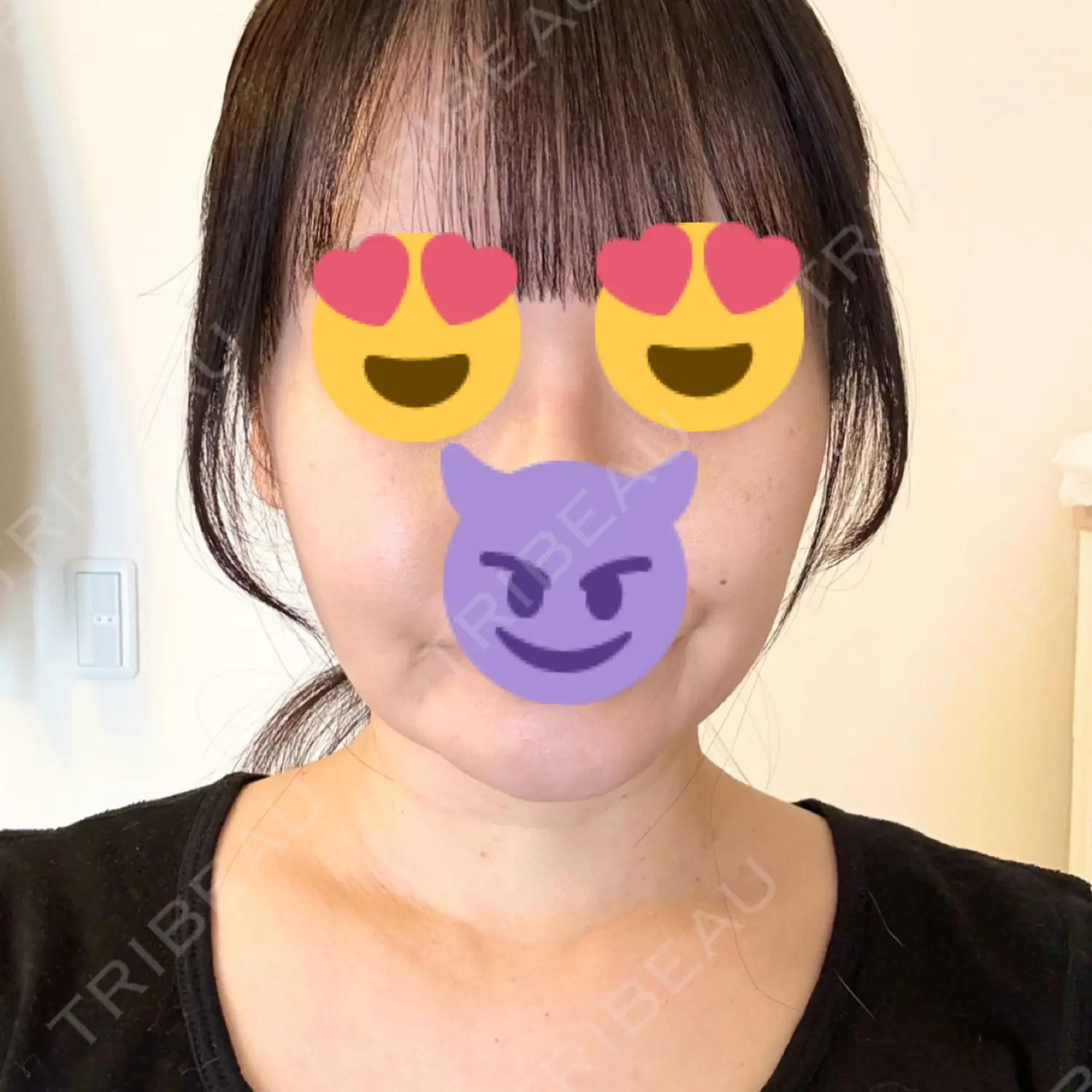 施術前の写真