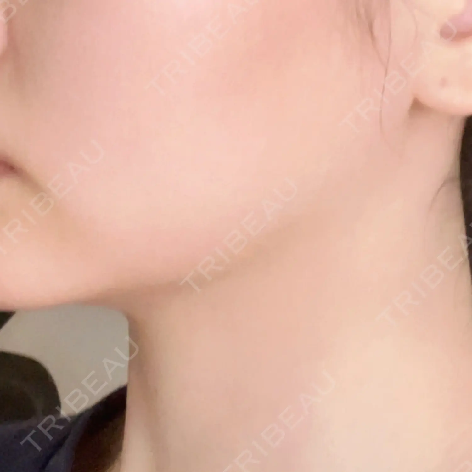 施術前の写真