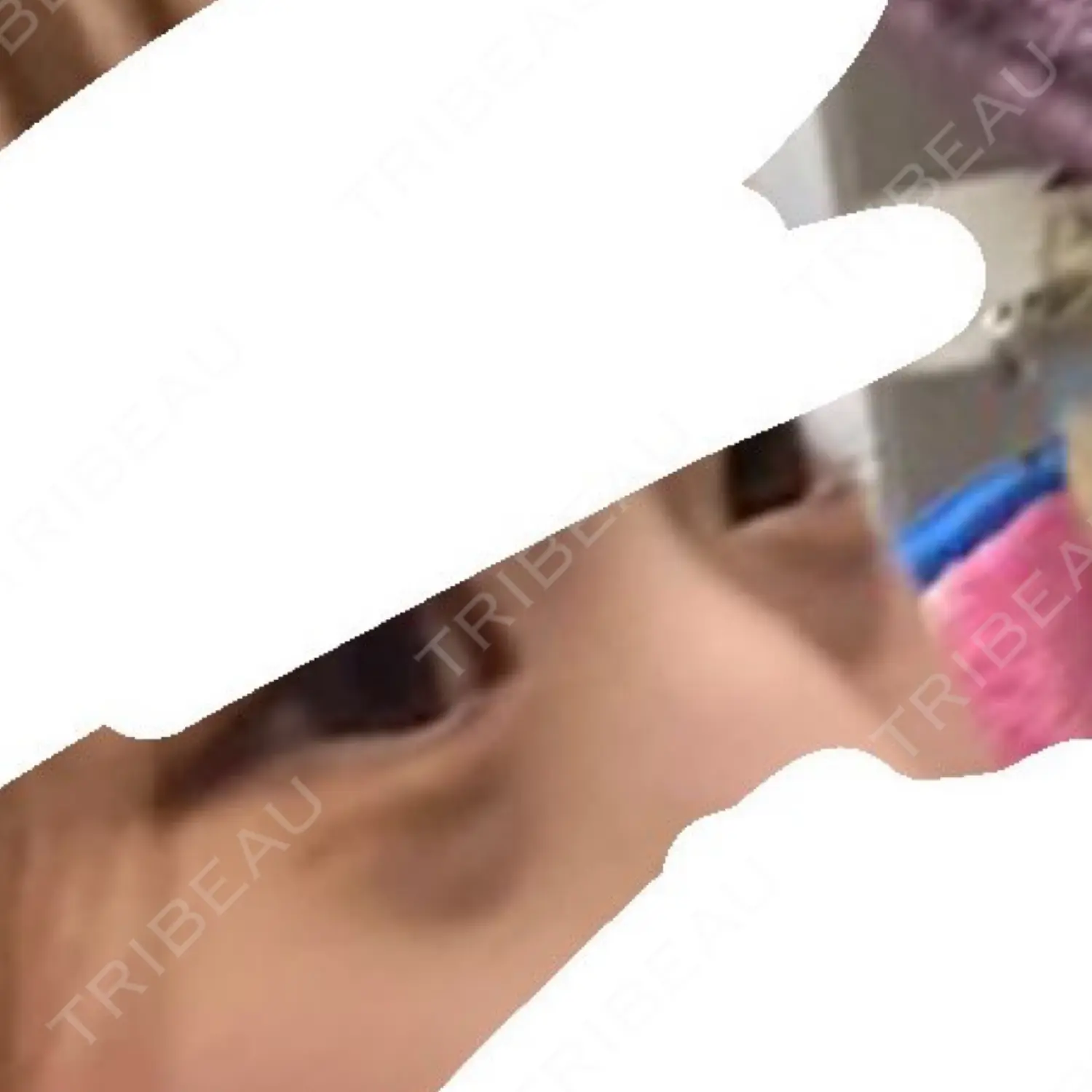 施術前の写真