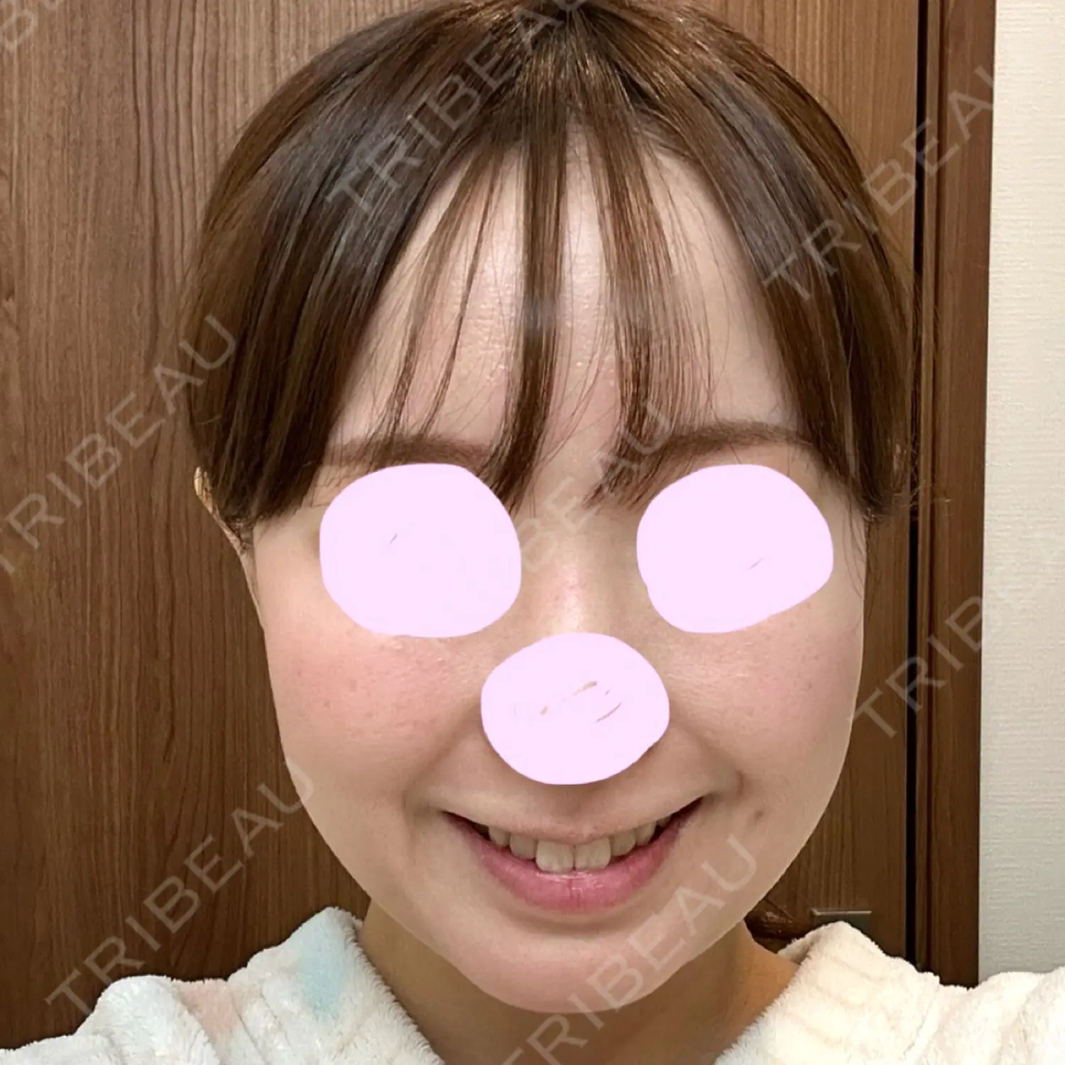 施術前の写真
