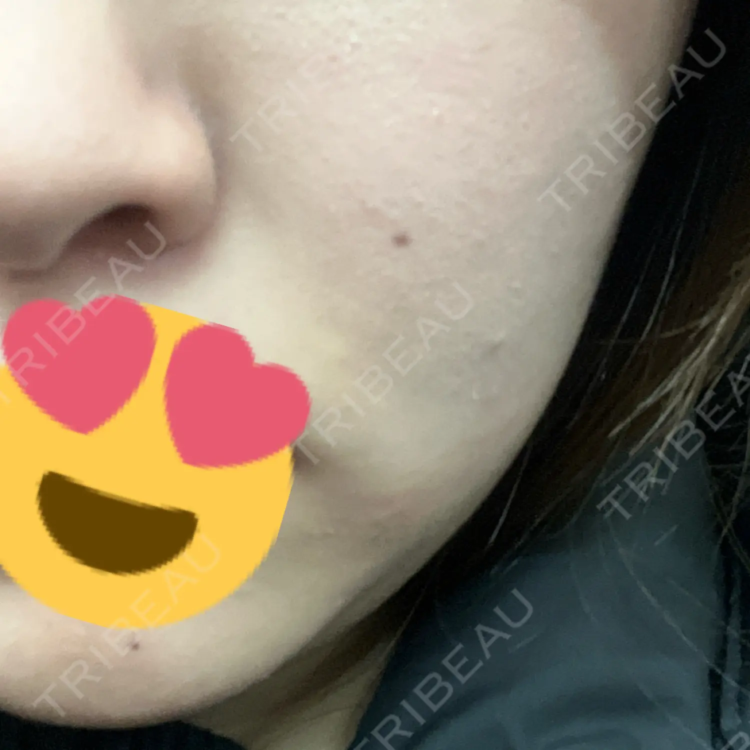 施術前の写真