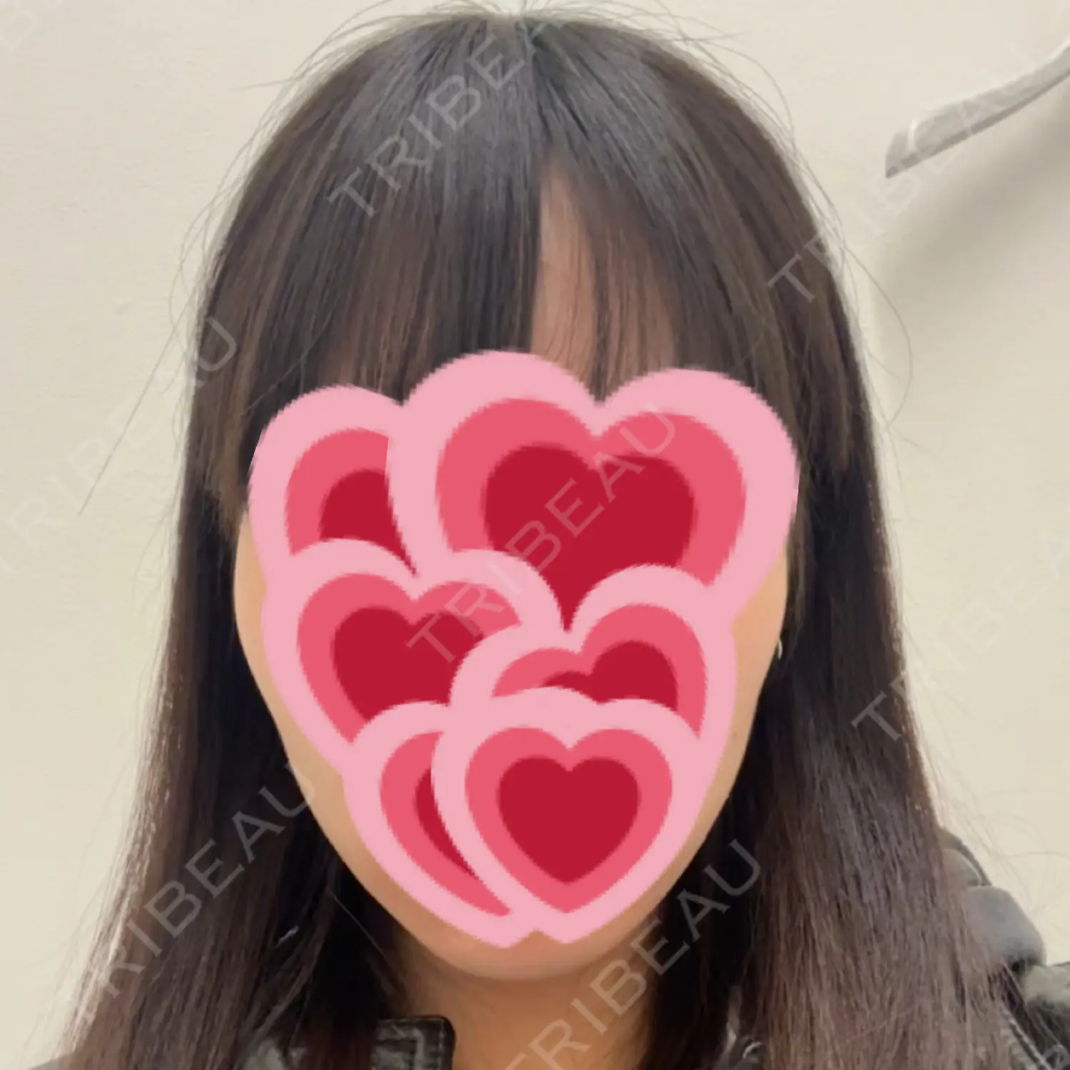 施術前の写真