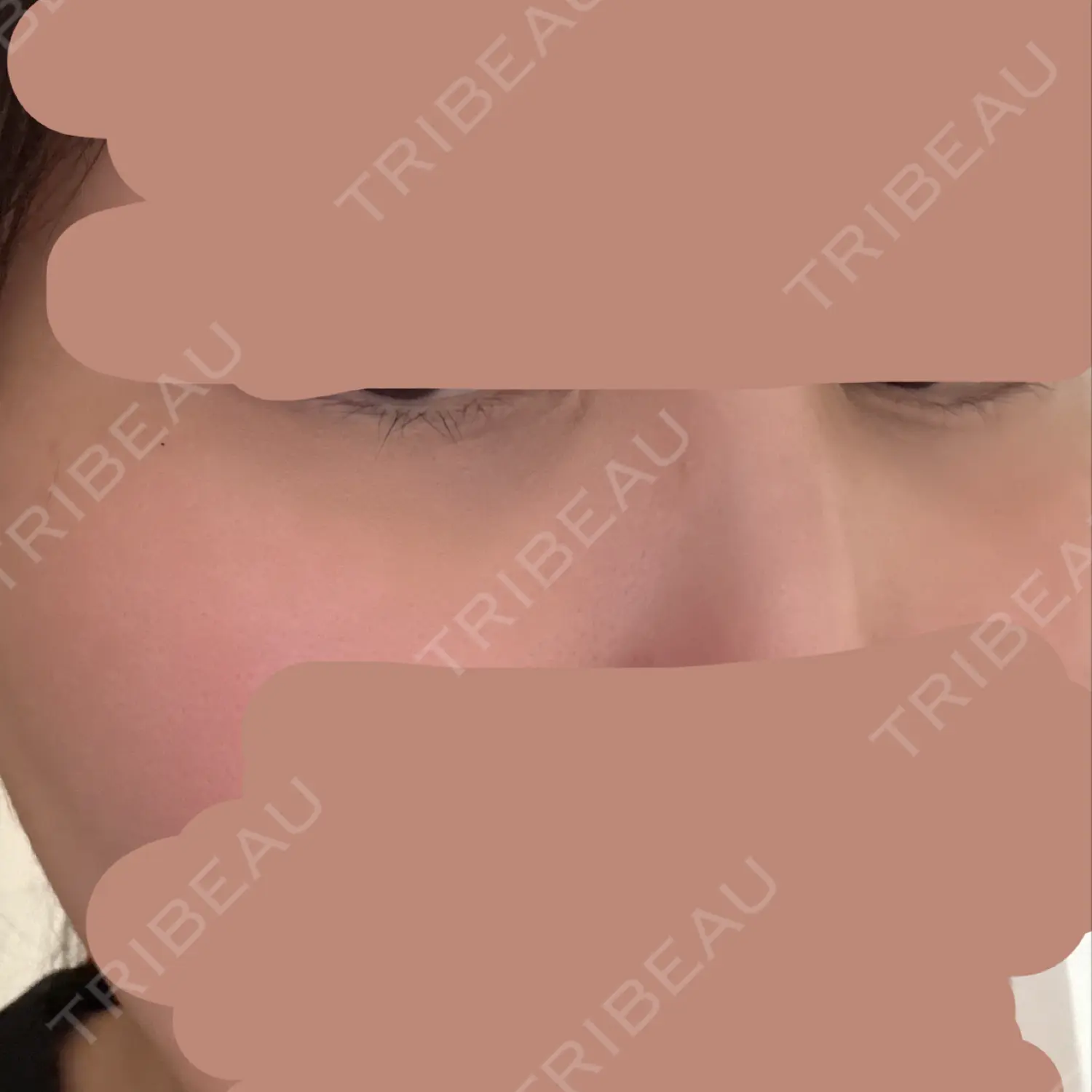 施術前の写真