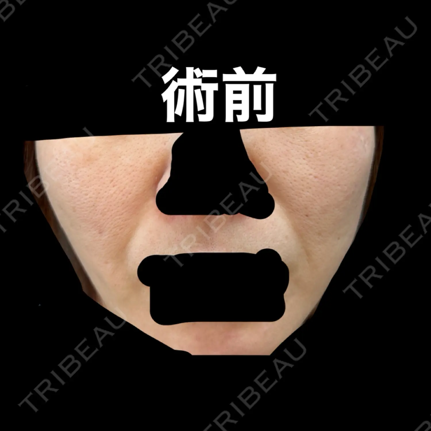 施術前の写真
