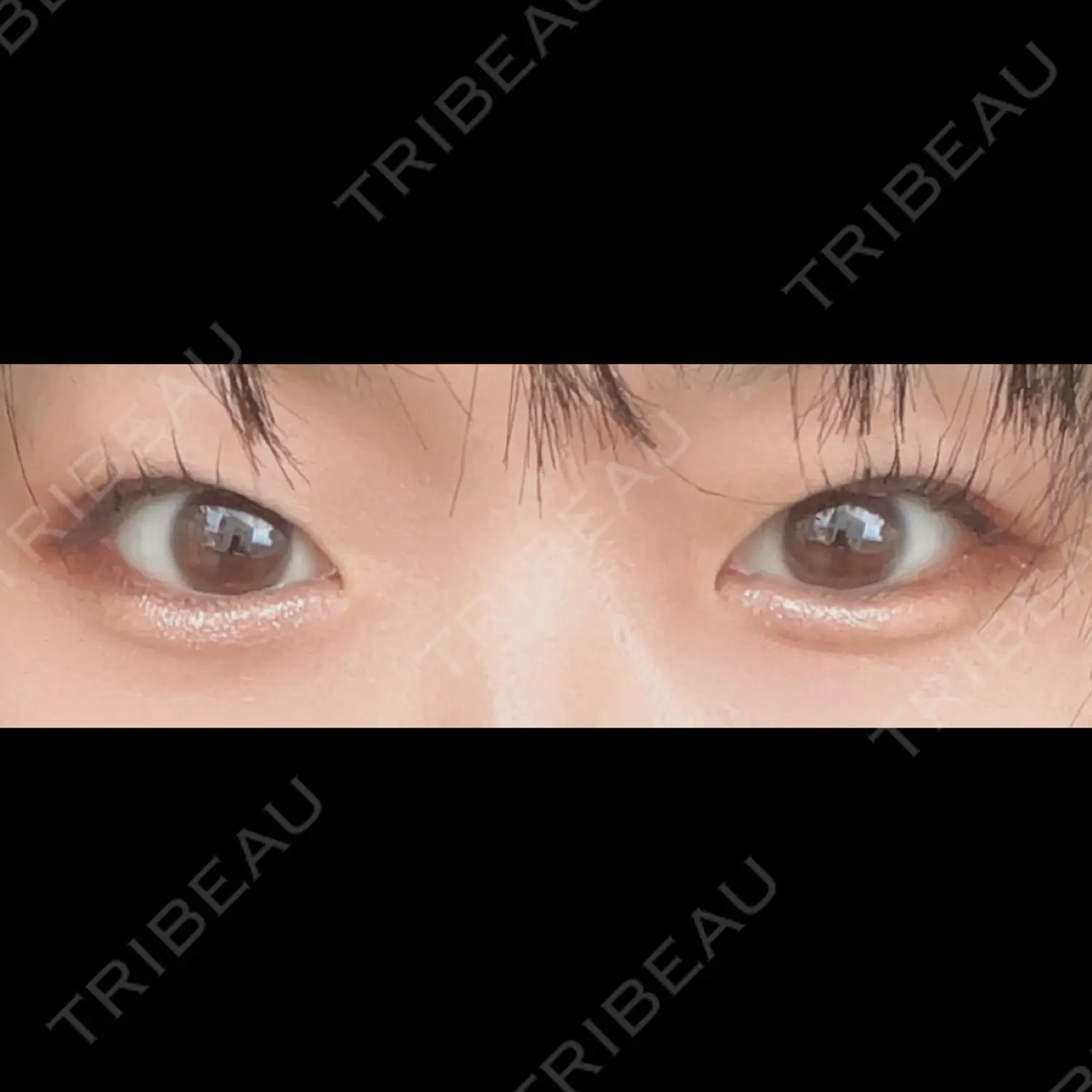施術前の写真