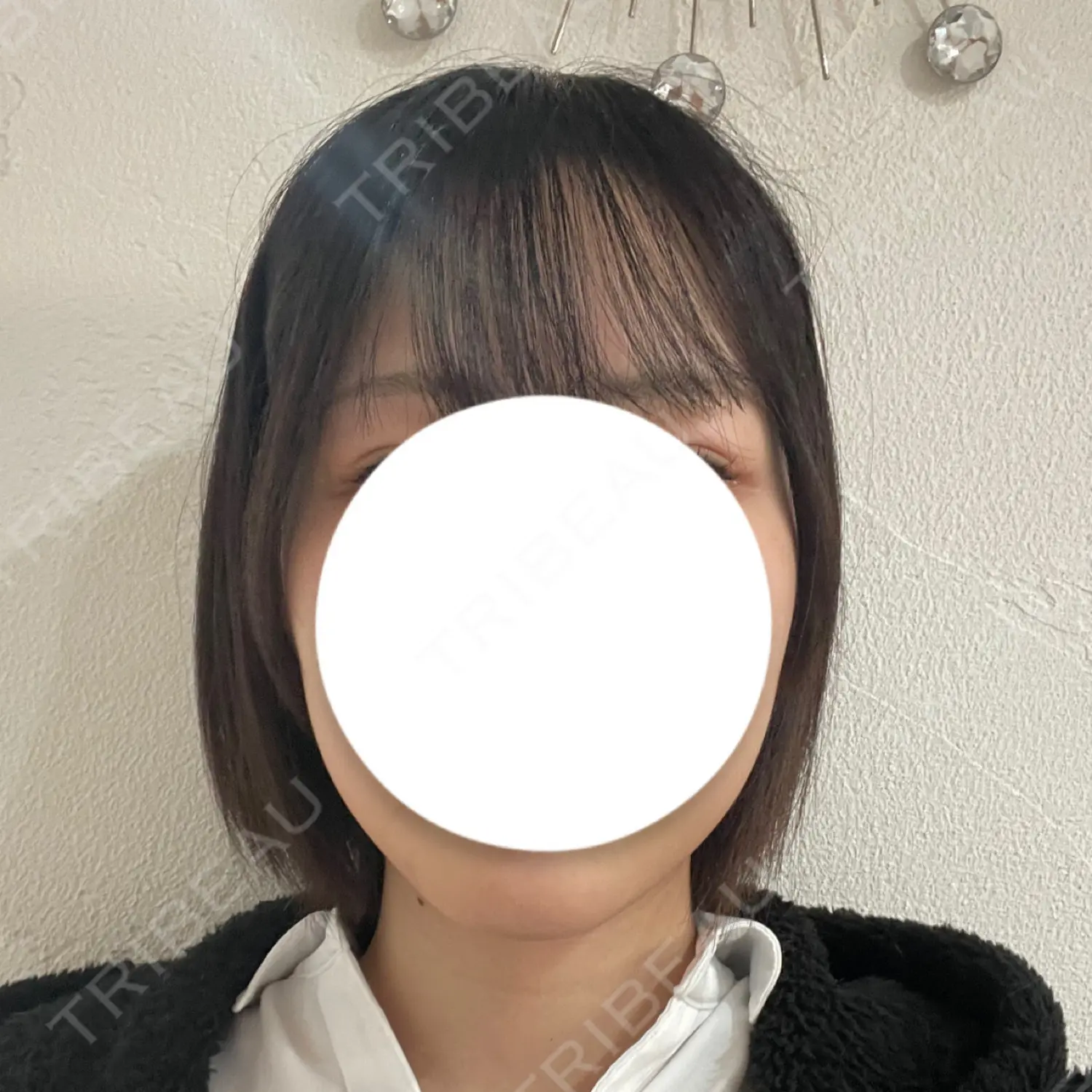 施術前の写真