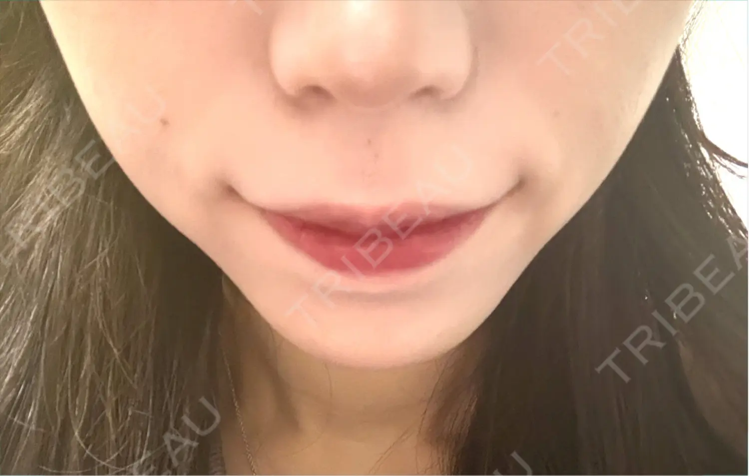 施術前の写真