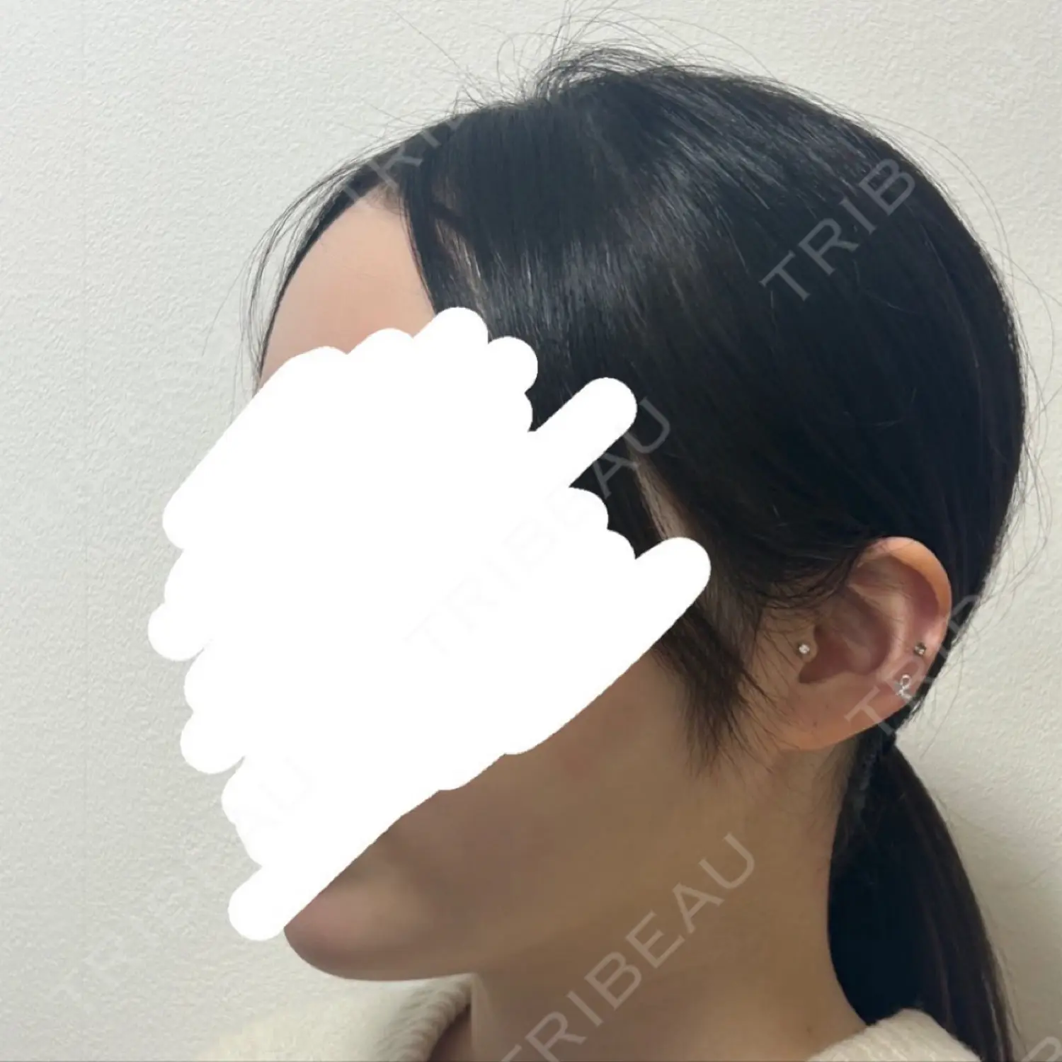 施術前の写真