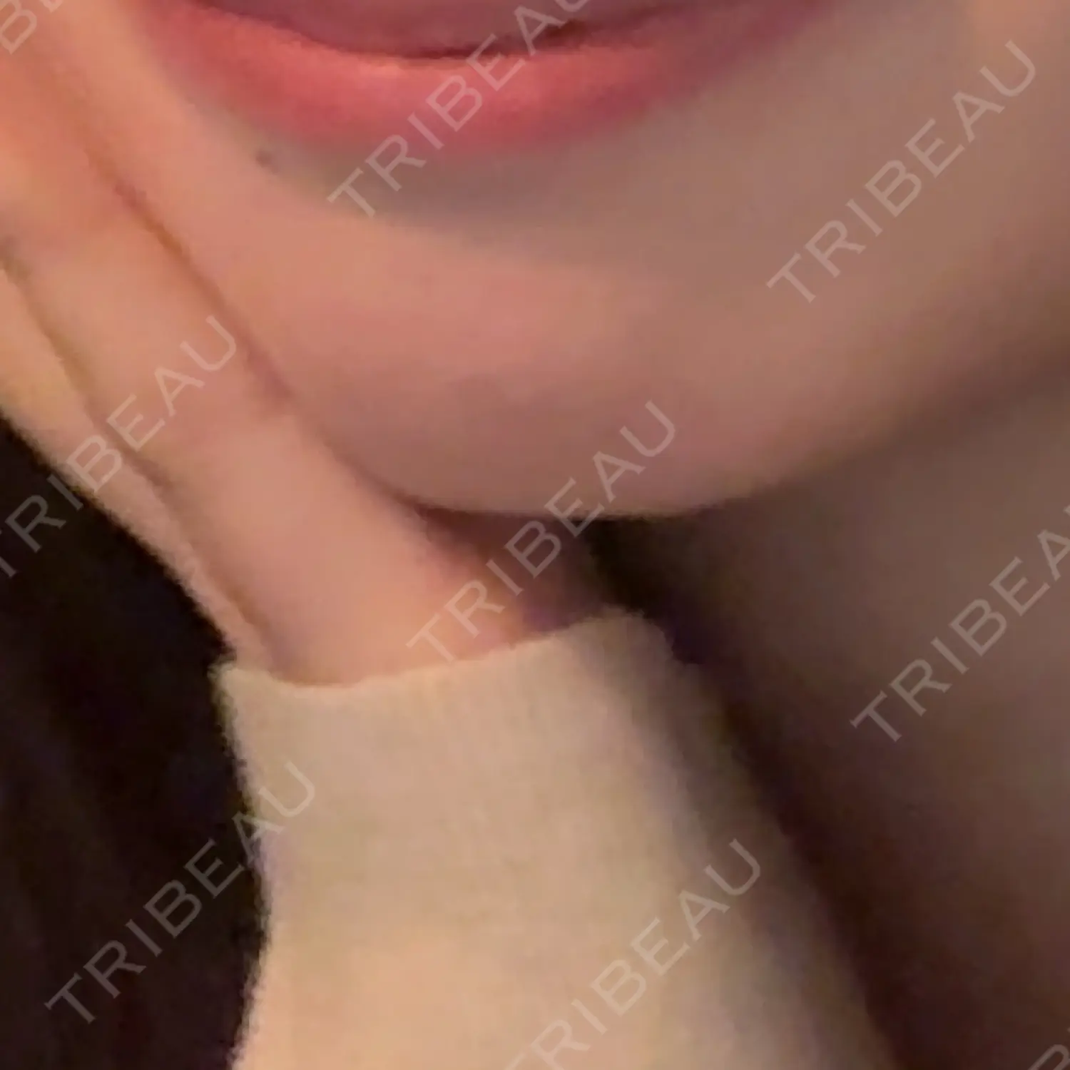 施術前の写真