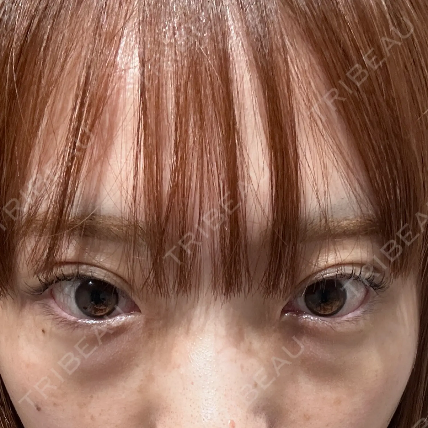 施術前の写真
