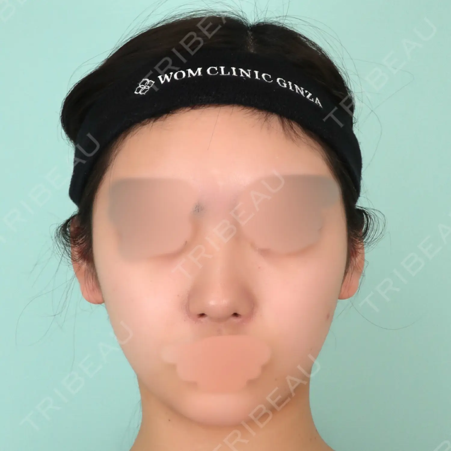 施術前の写真