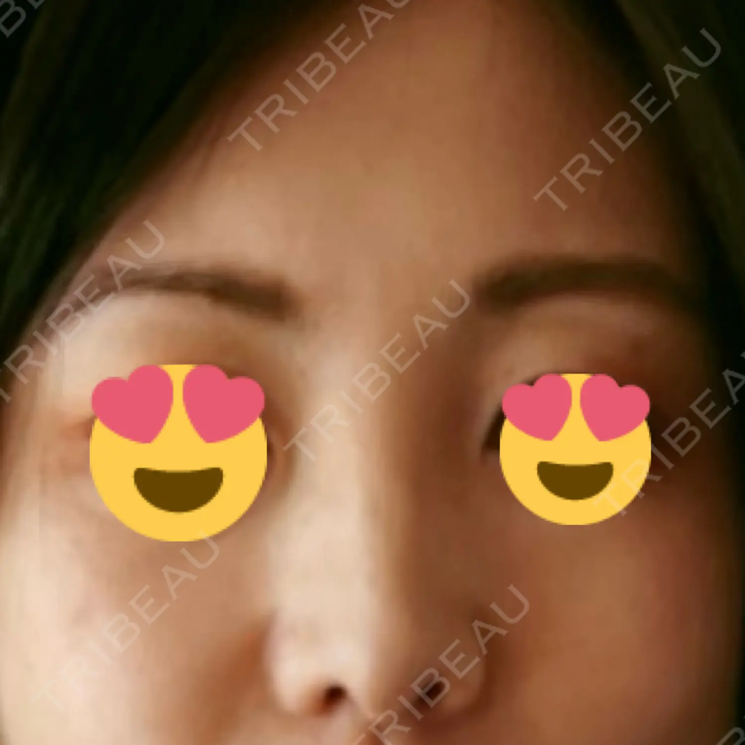 施術前の写真
