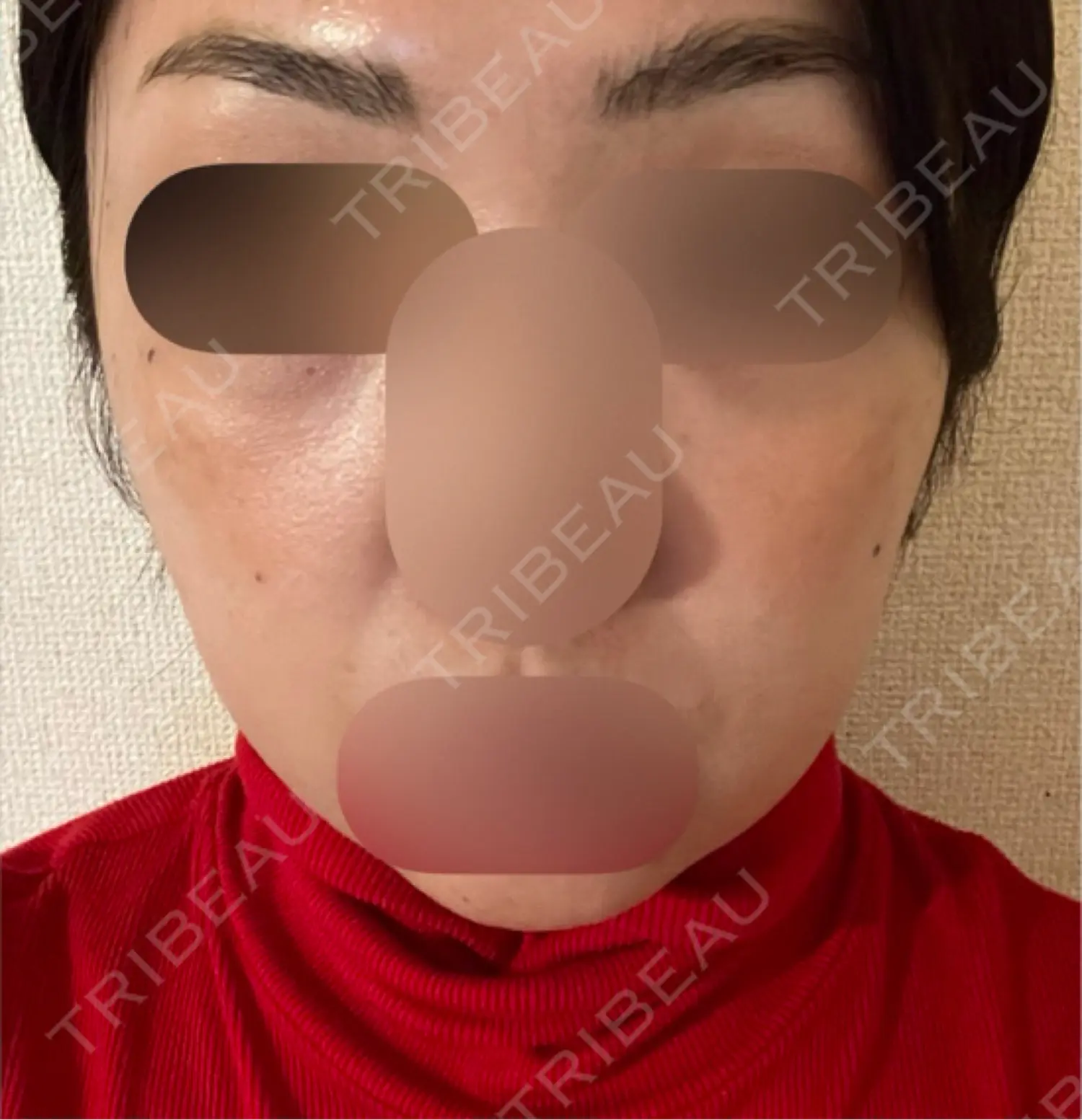 施術前の写真