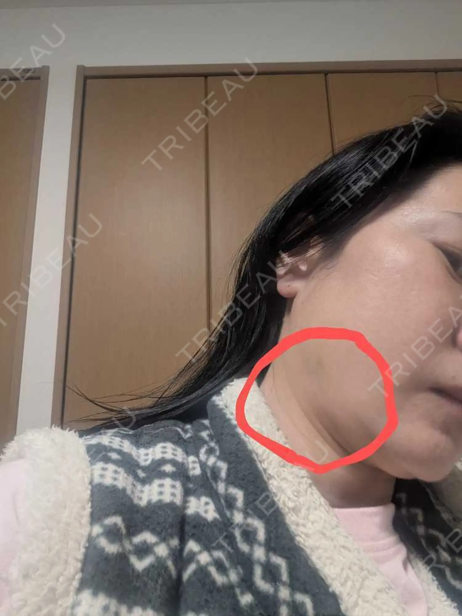 施術前の写真
