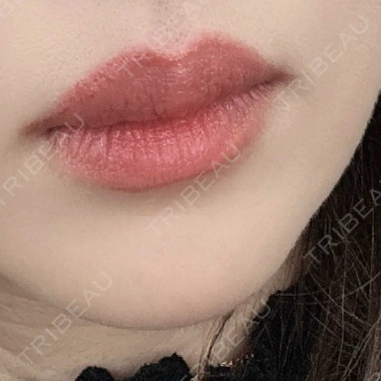 施術前の写真