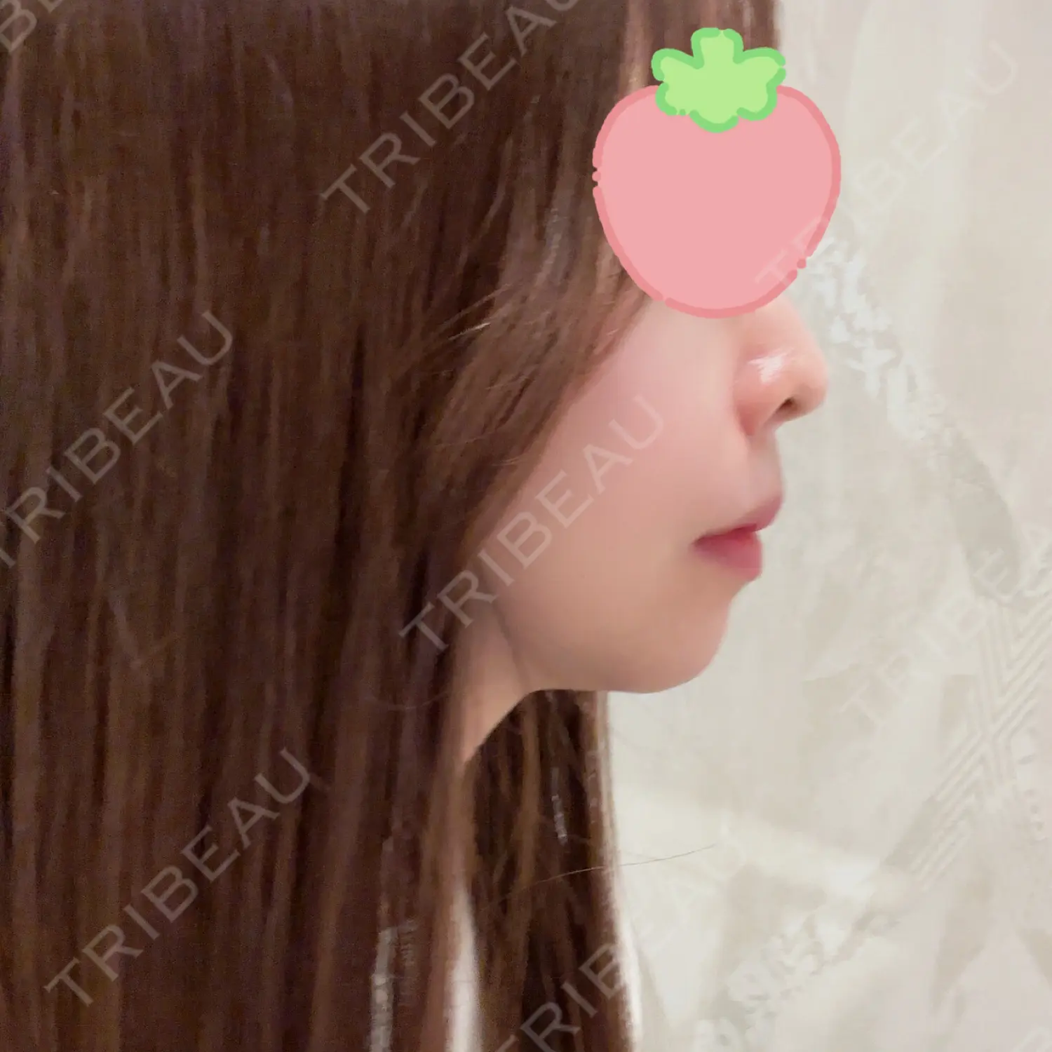 施術前の写真