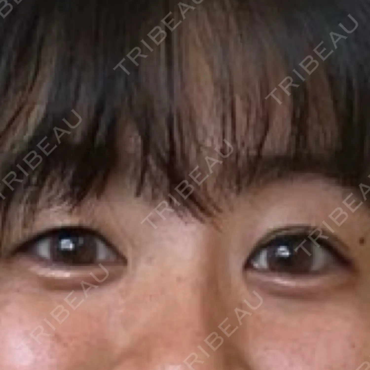 施術前の写真
