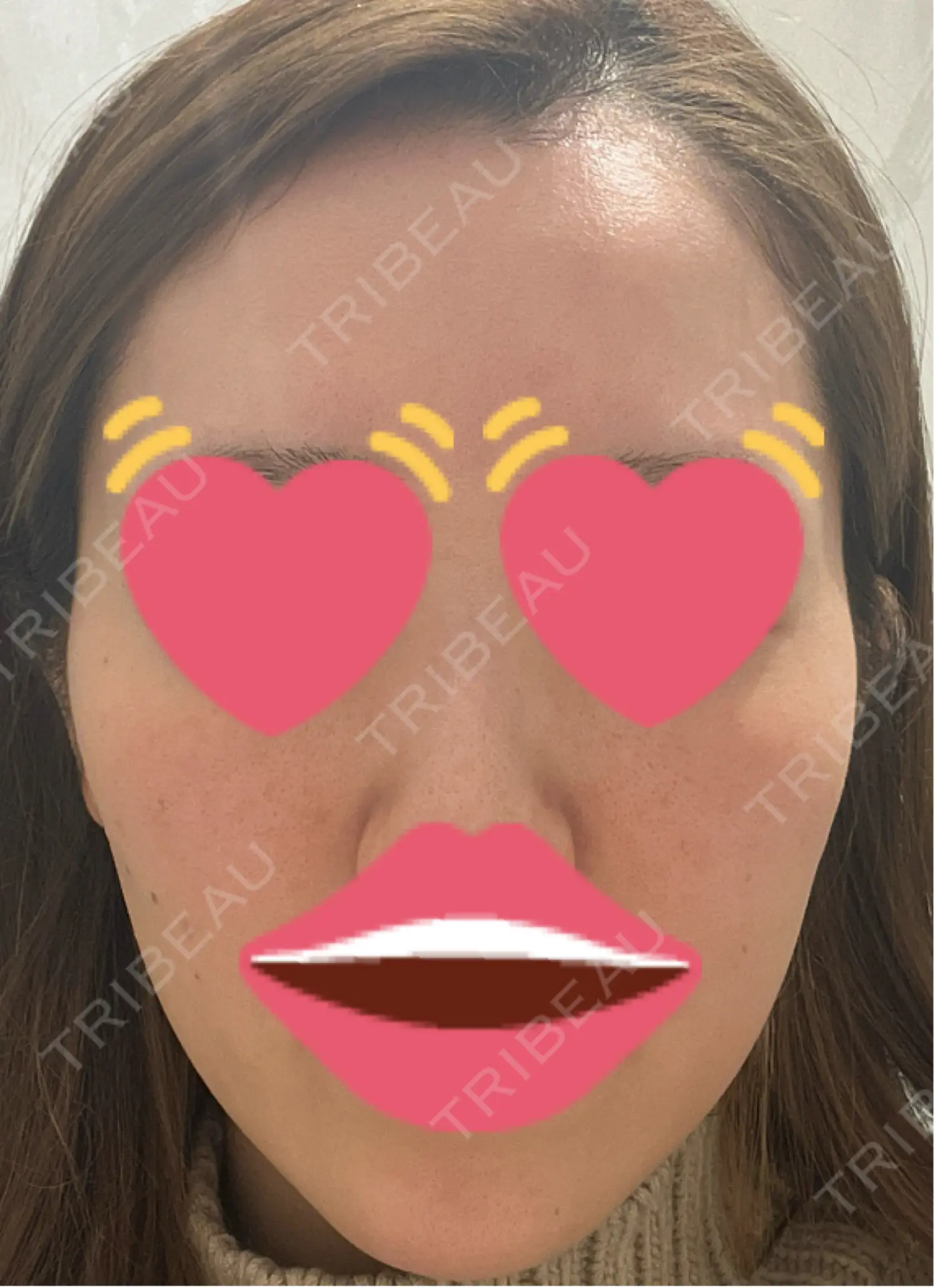 施術前の写真
