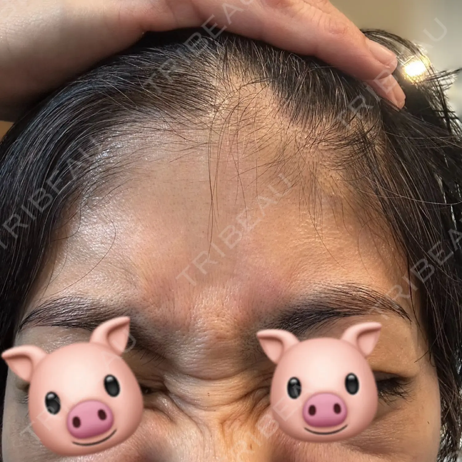 施術前の写真