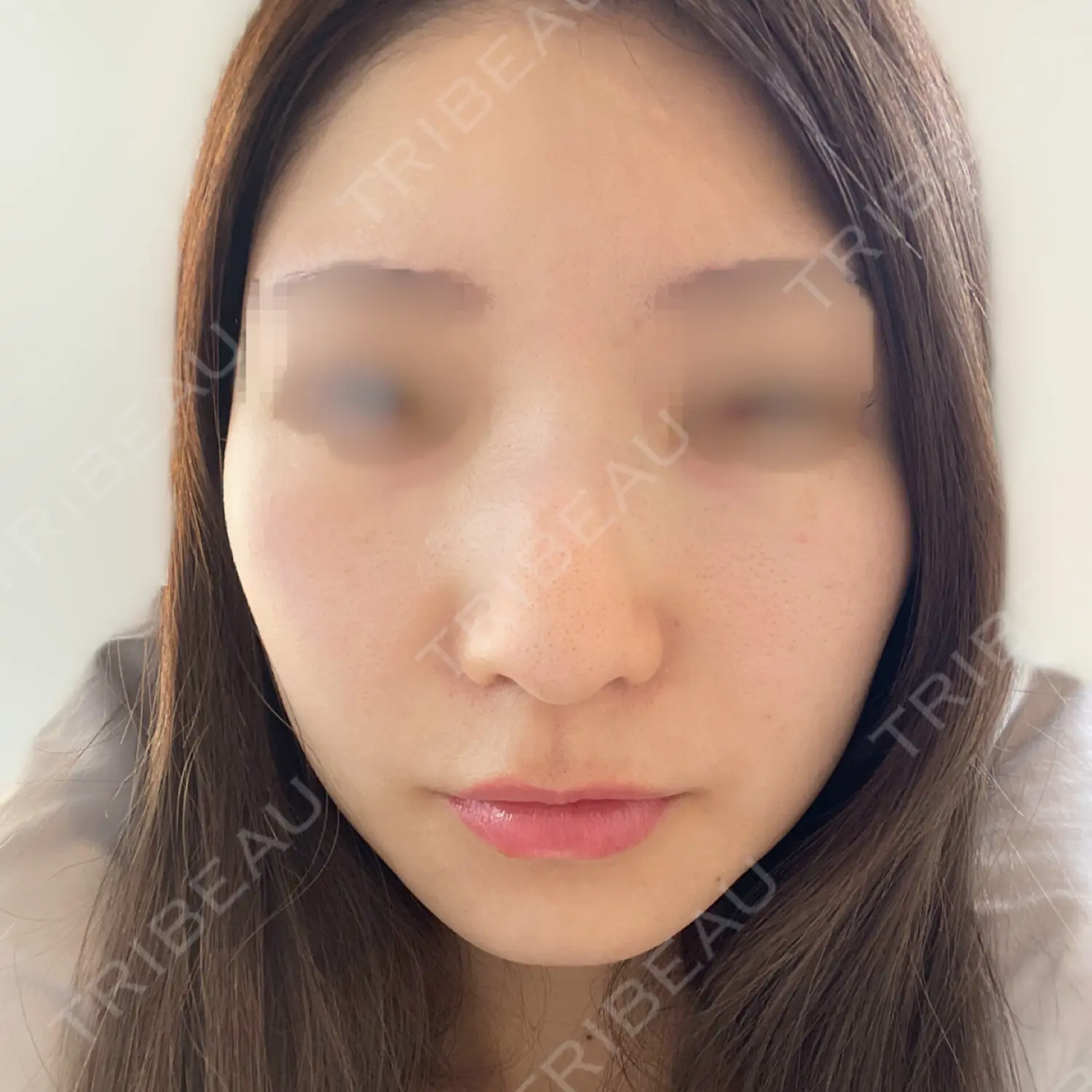 施術前の写真