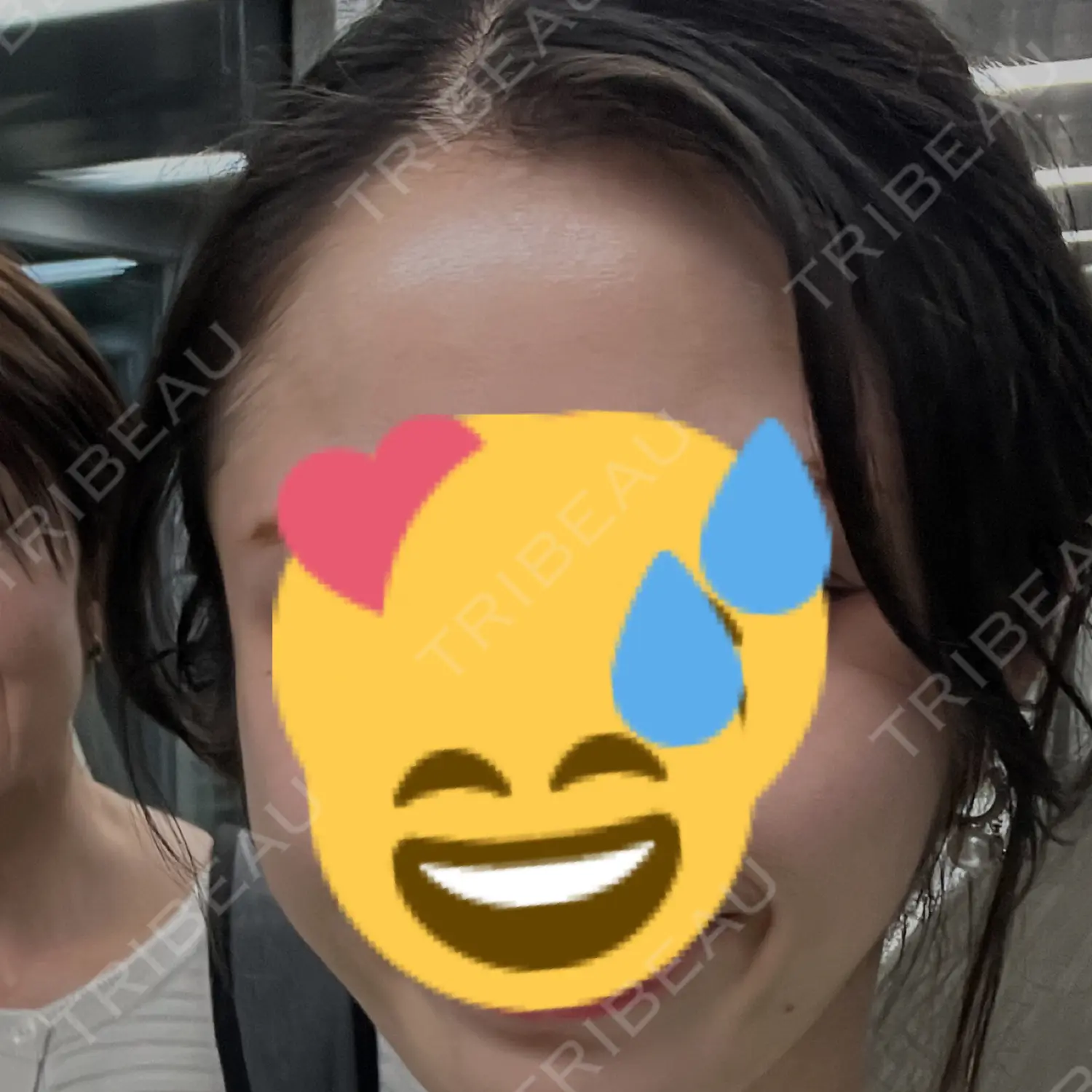 施術前の写真