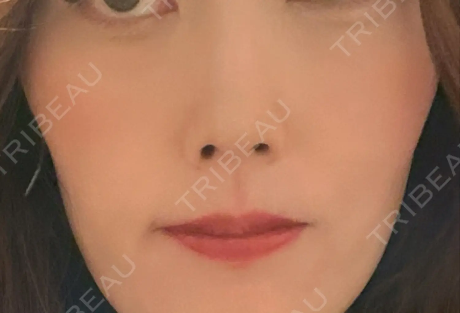 施術前の写真