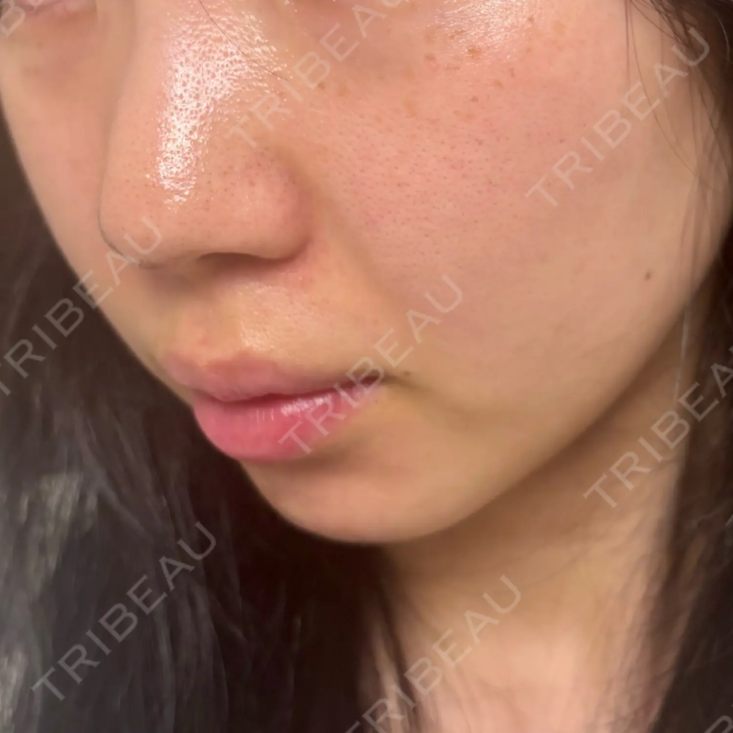 施術前の写真