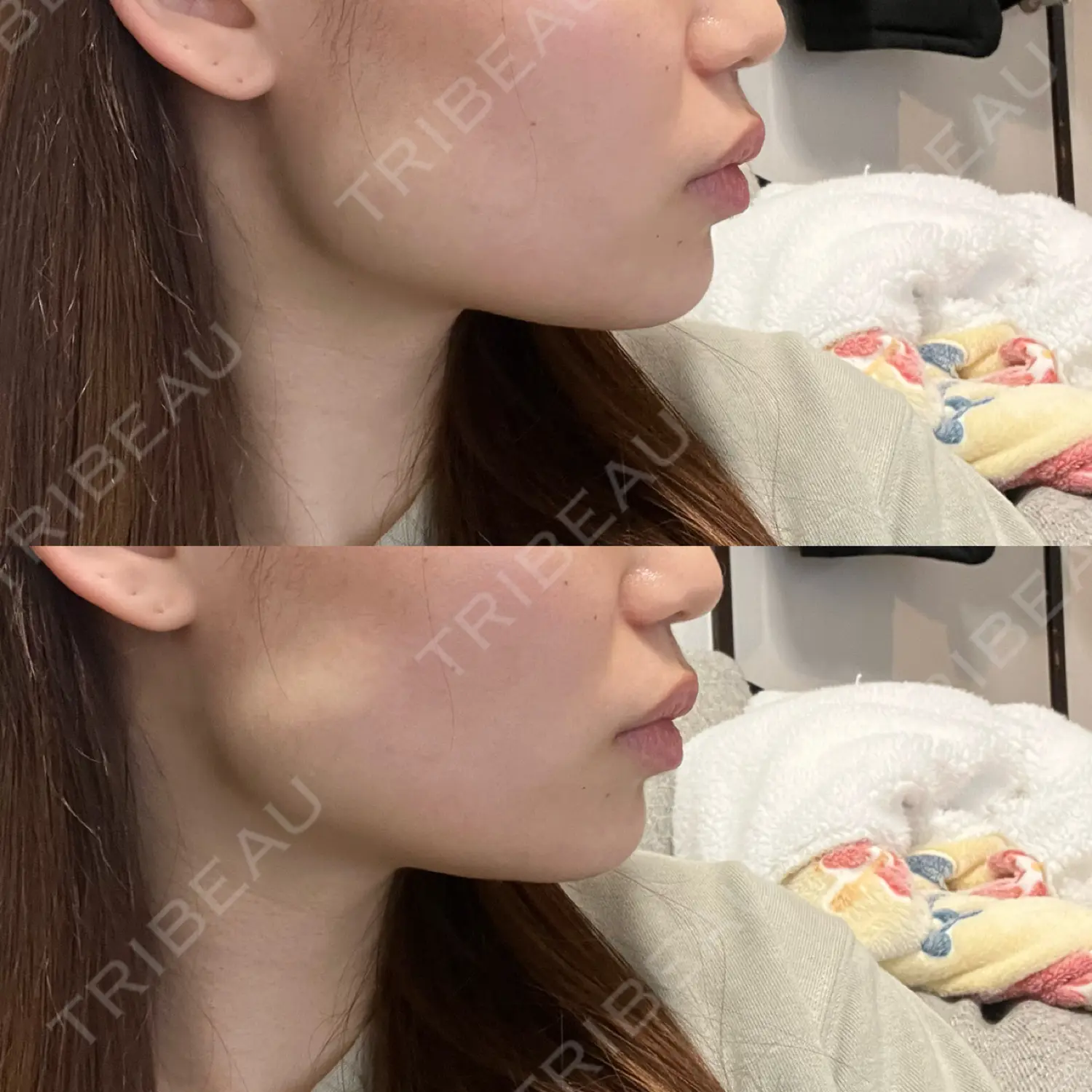 施術前の写真