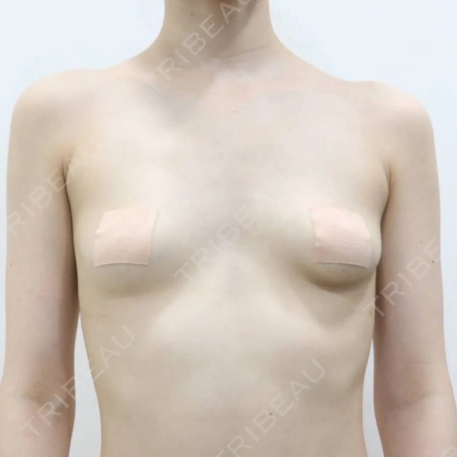 施術前の写真