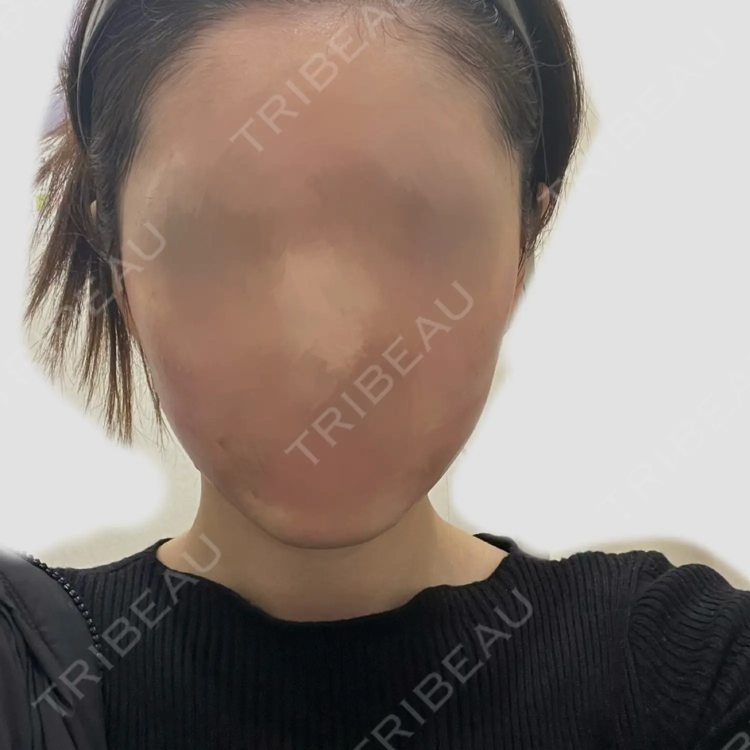 施術前の写真