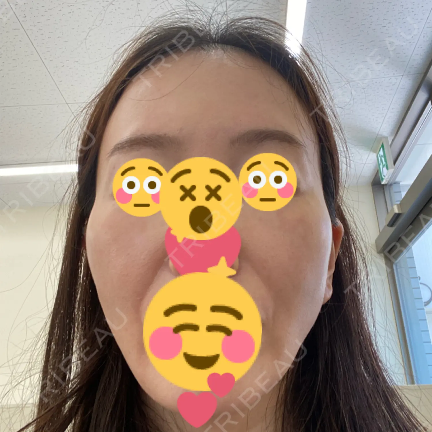 施術前の写真