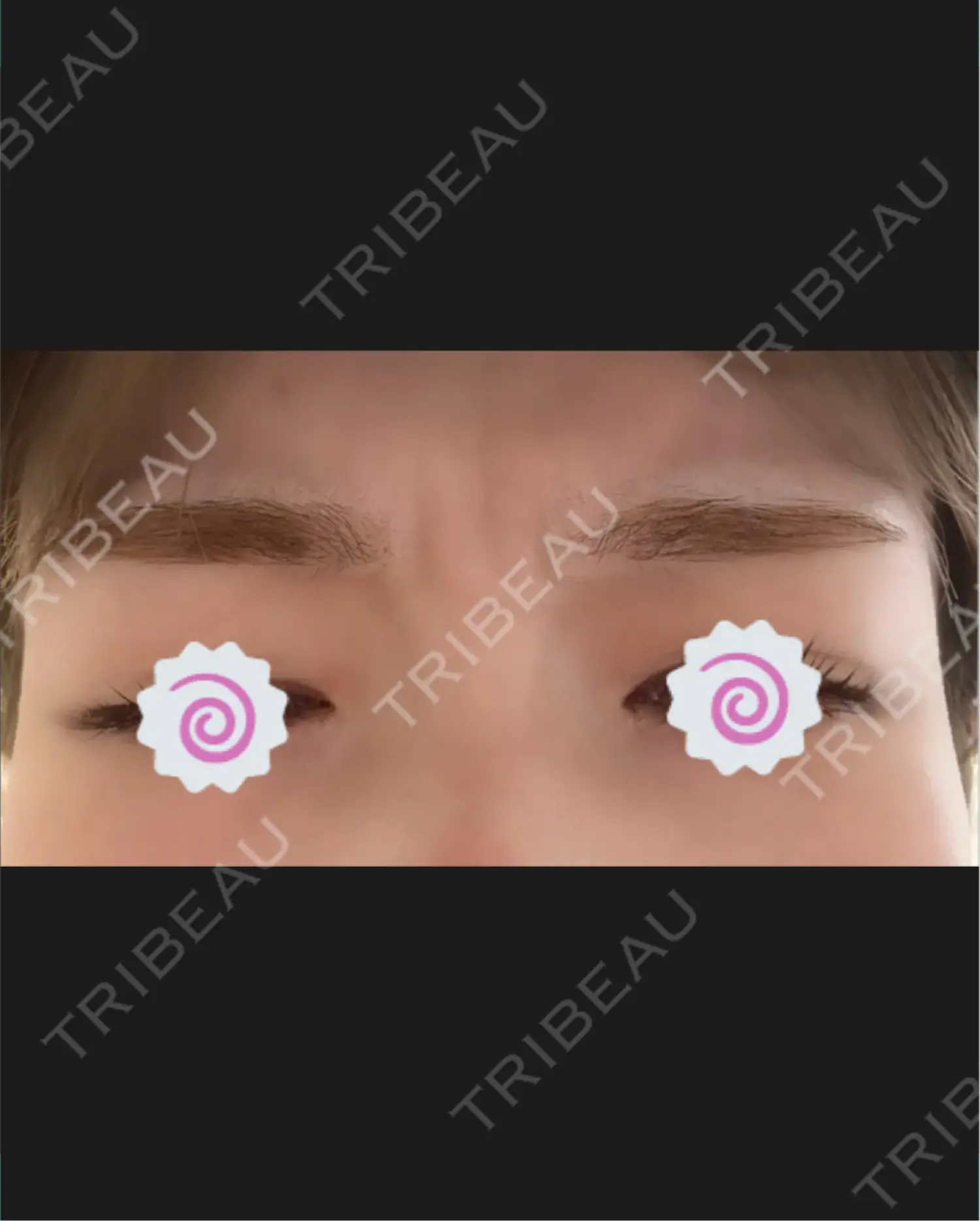 施術前の写真