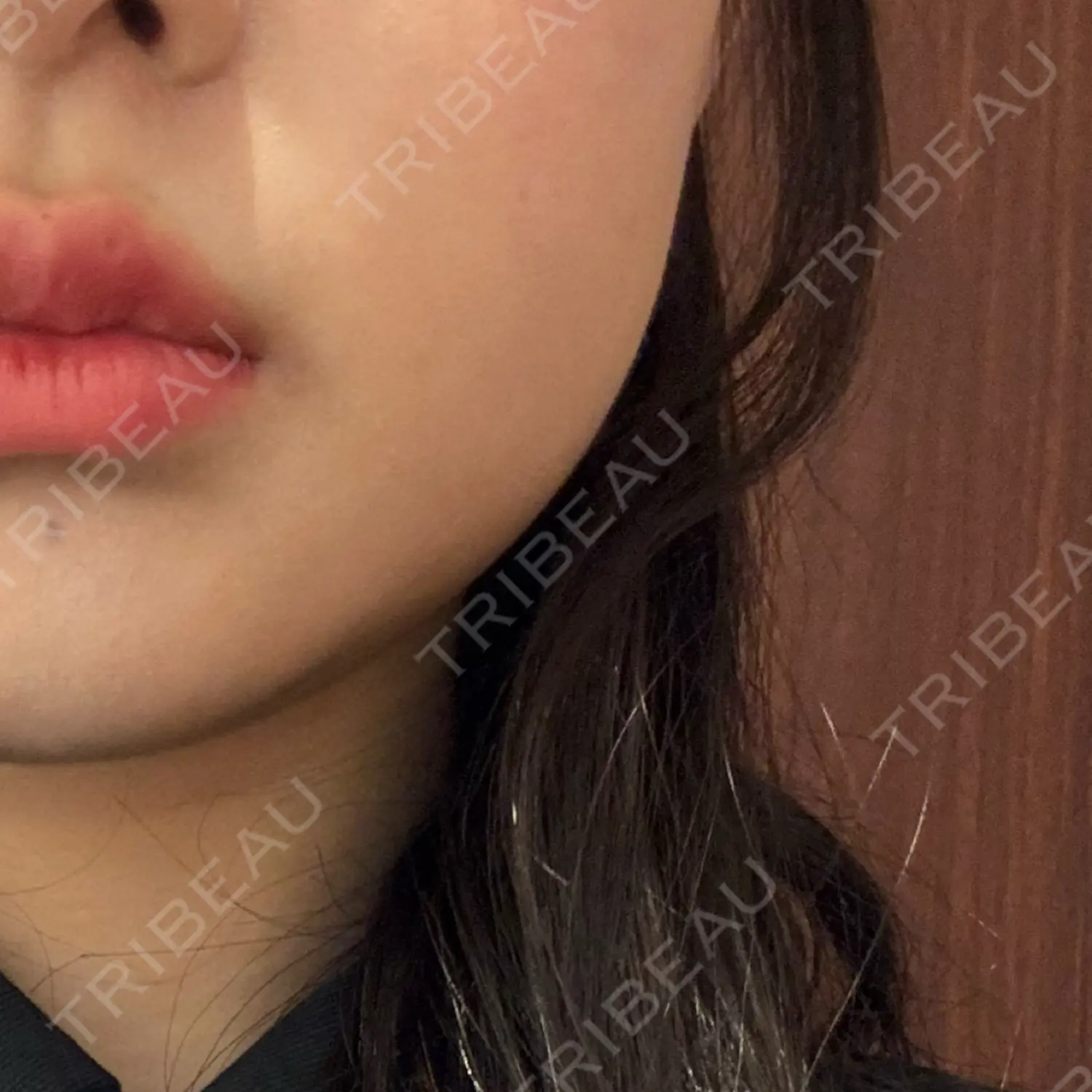 施術前の写真