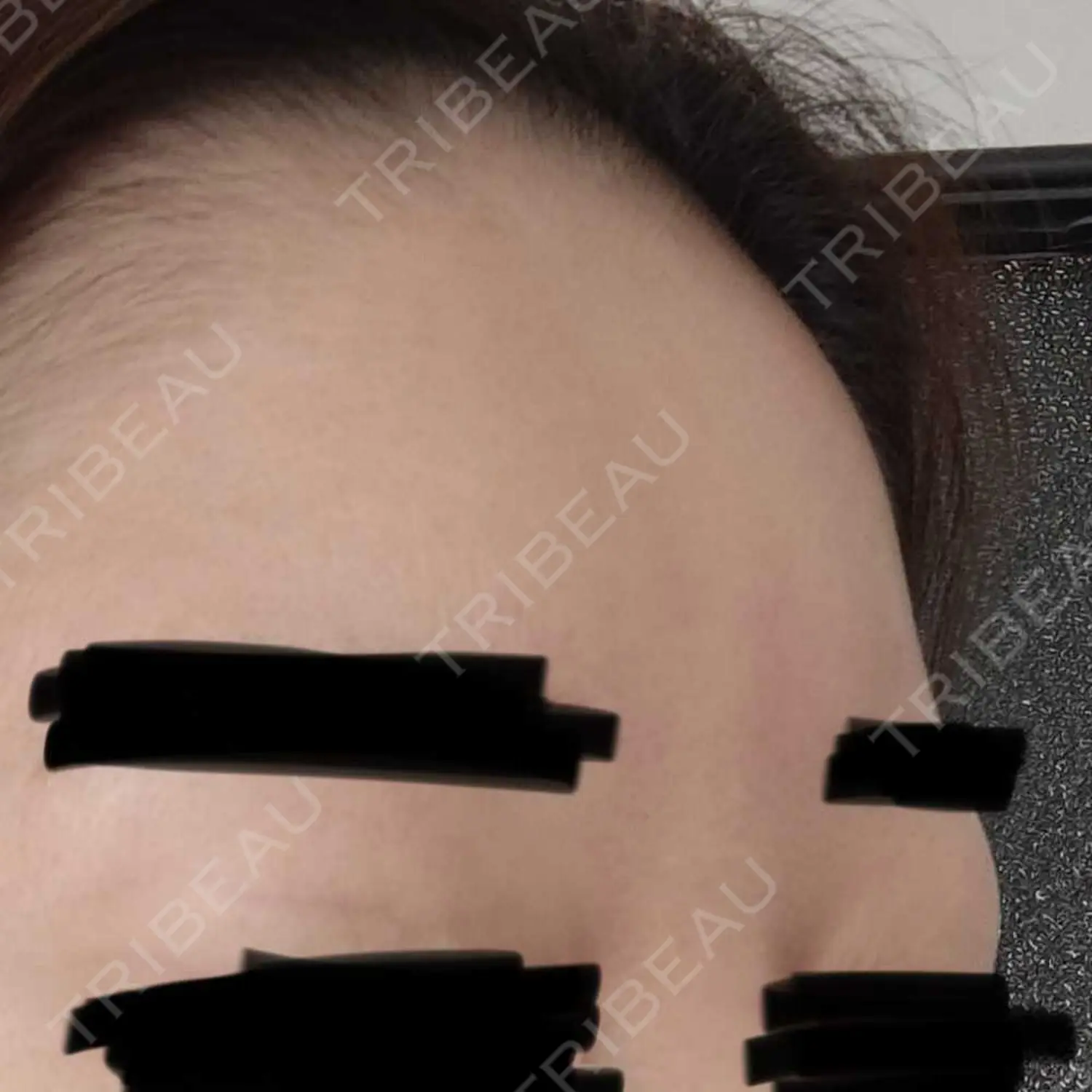 施術前の写真